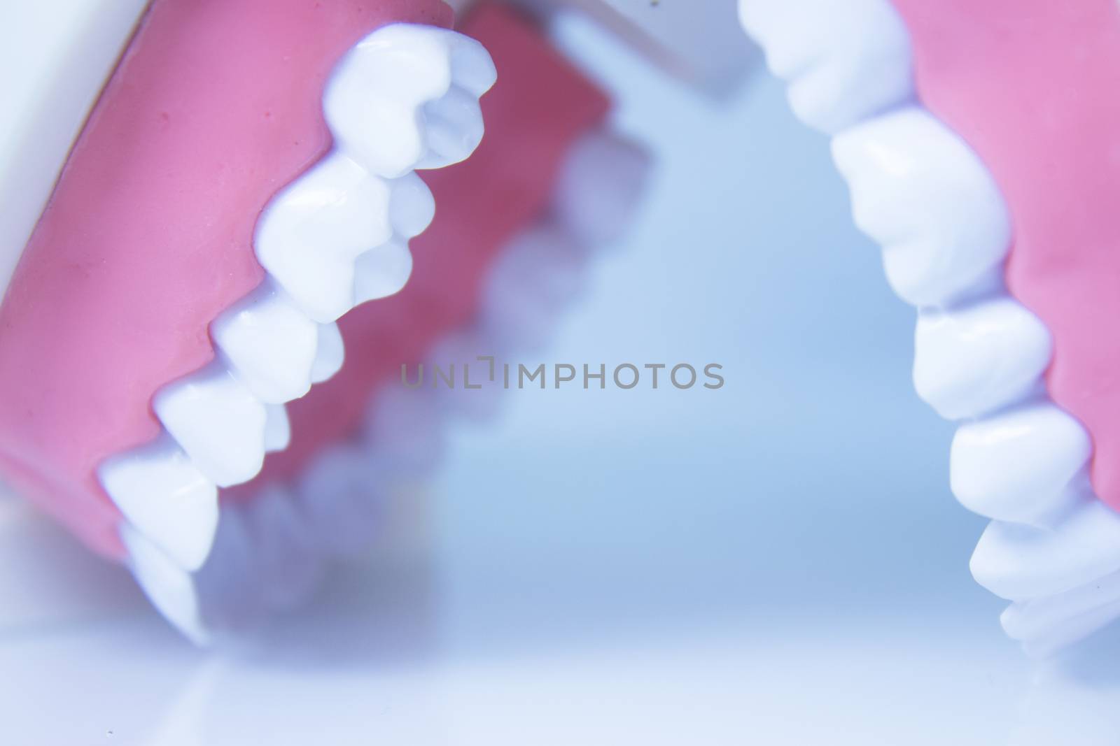 Model denture with metal orthodontics by GemaIbarra