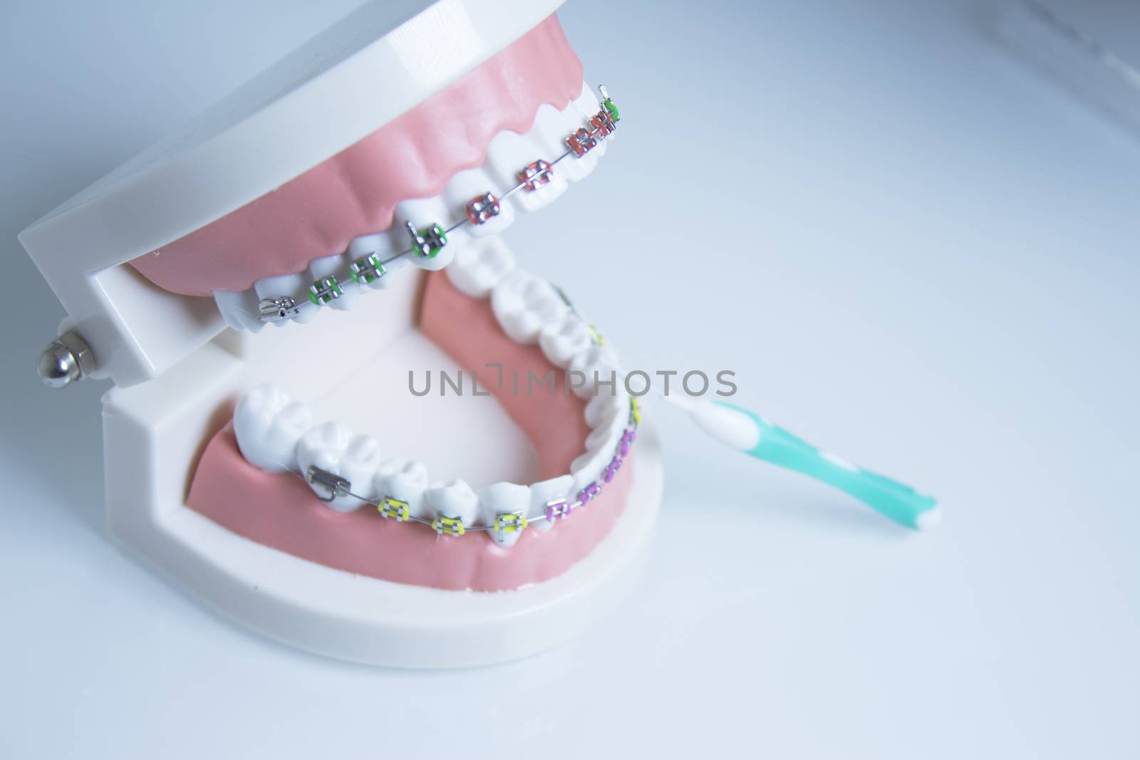 Model denture with metal orthodontics. No people