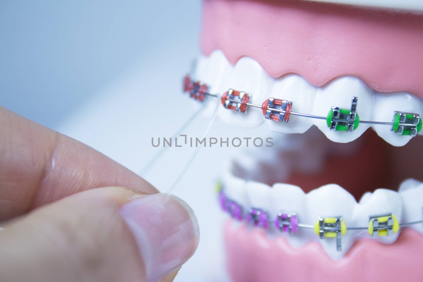 Model denture with metal orthodontics. No people