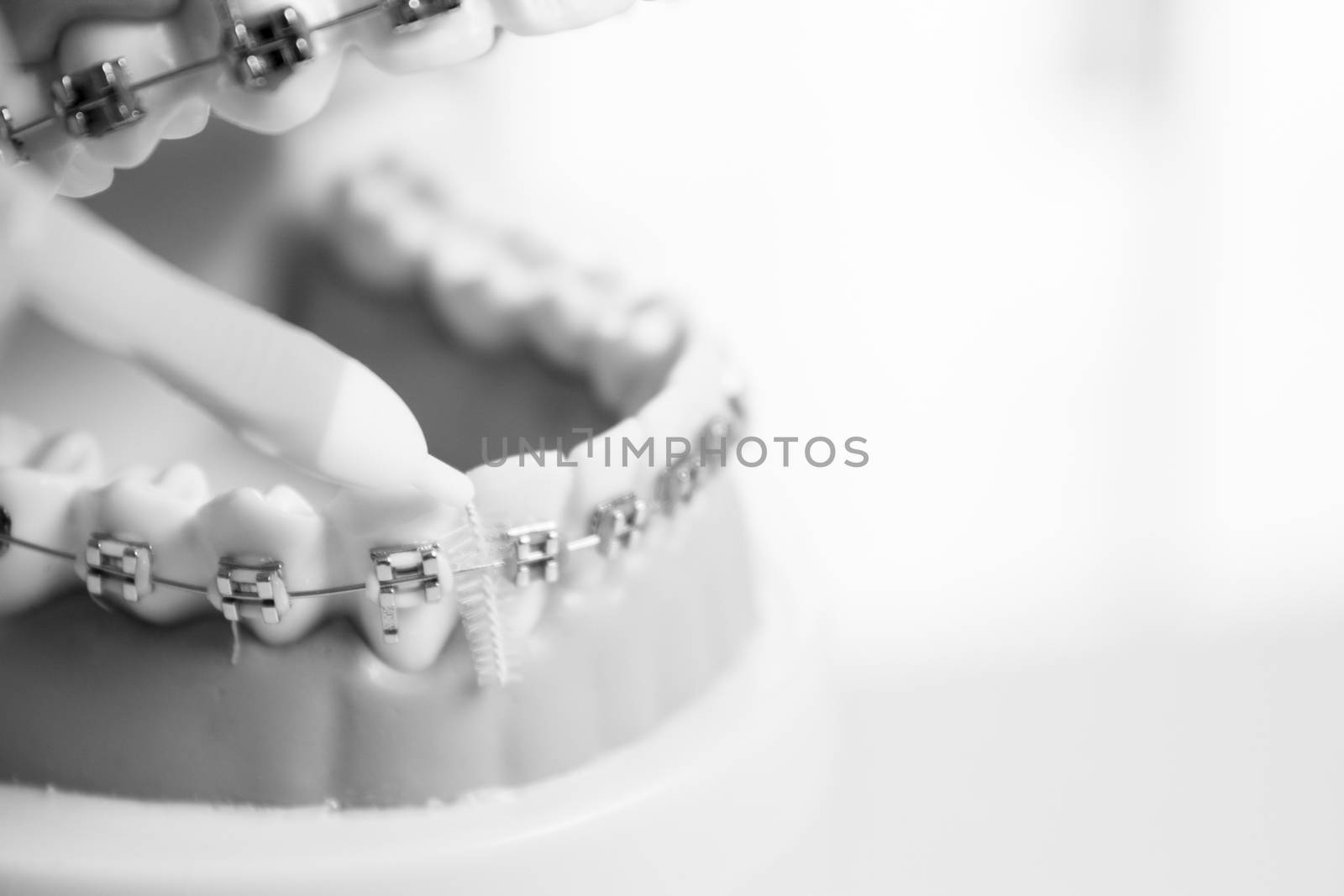 Model denture with metal orthodontics. No people