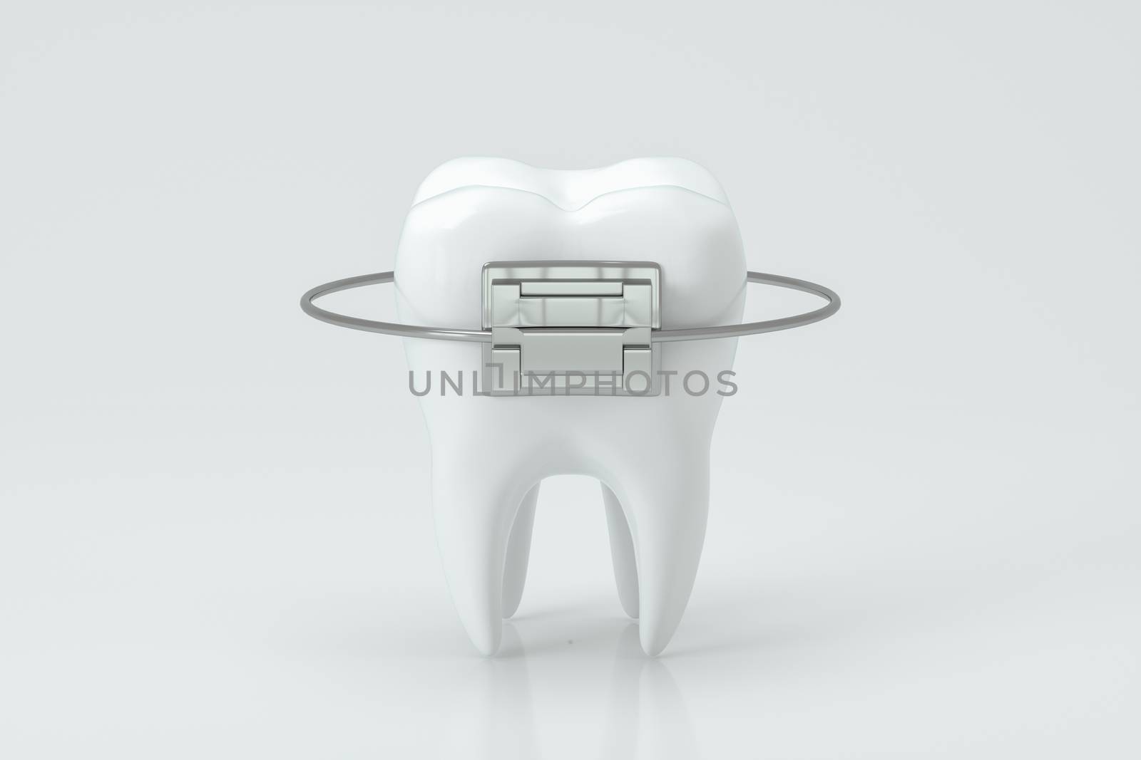 Dental braces and the teeth, 3d rendering. Computer digital drawing.