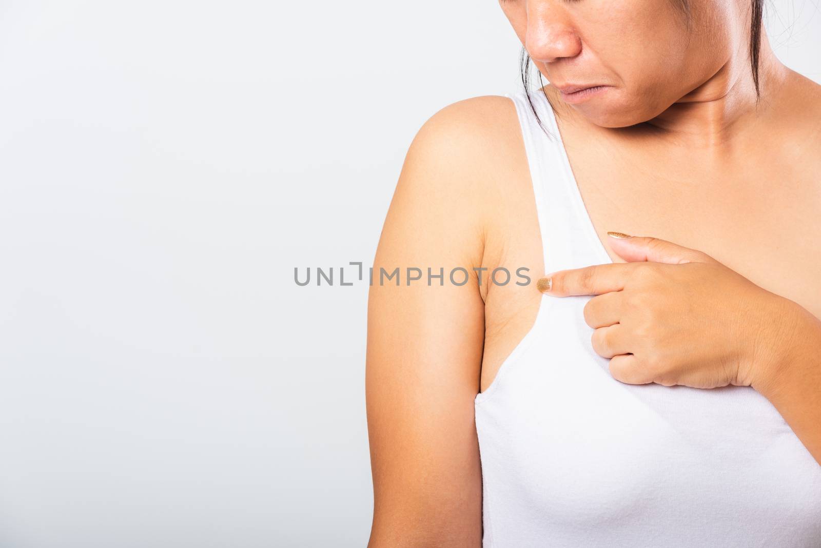 Close up of Asian woman pointing her skin underarm she problem armpit fat underarm wrinkled skin, problem armpit skin, studio isolated on white background, Healthy excess fat concept