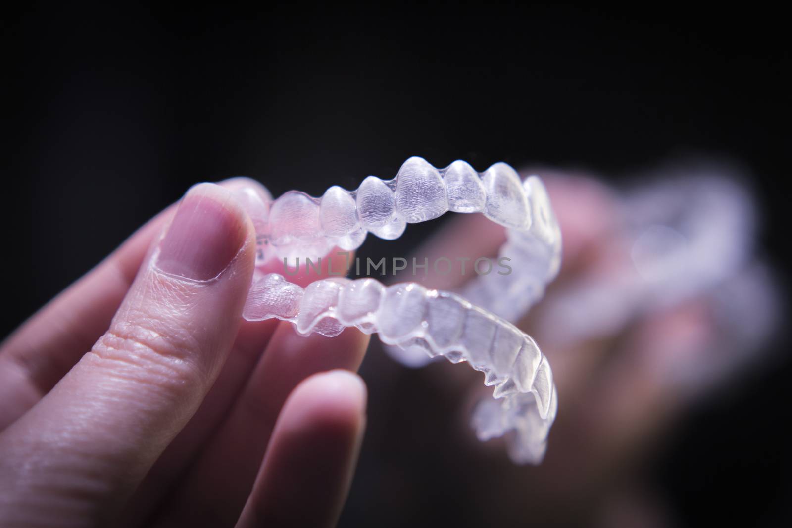 Woman hand holding invisible orthodontics by GemaIbarra