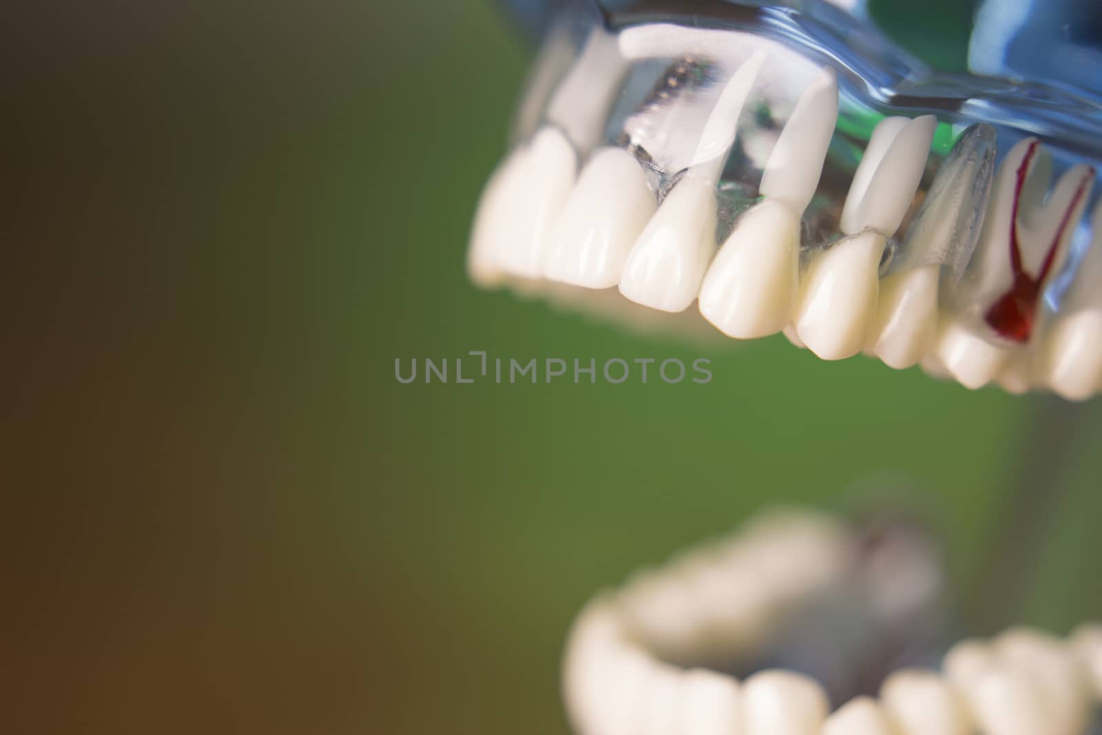 Denture for dentistry students by GemaIbarra