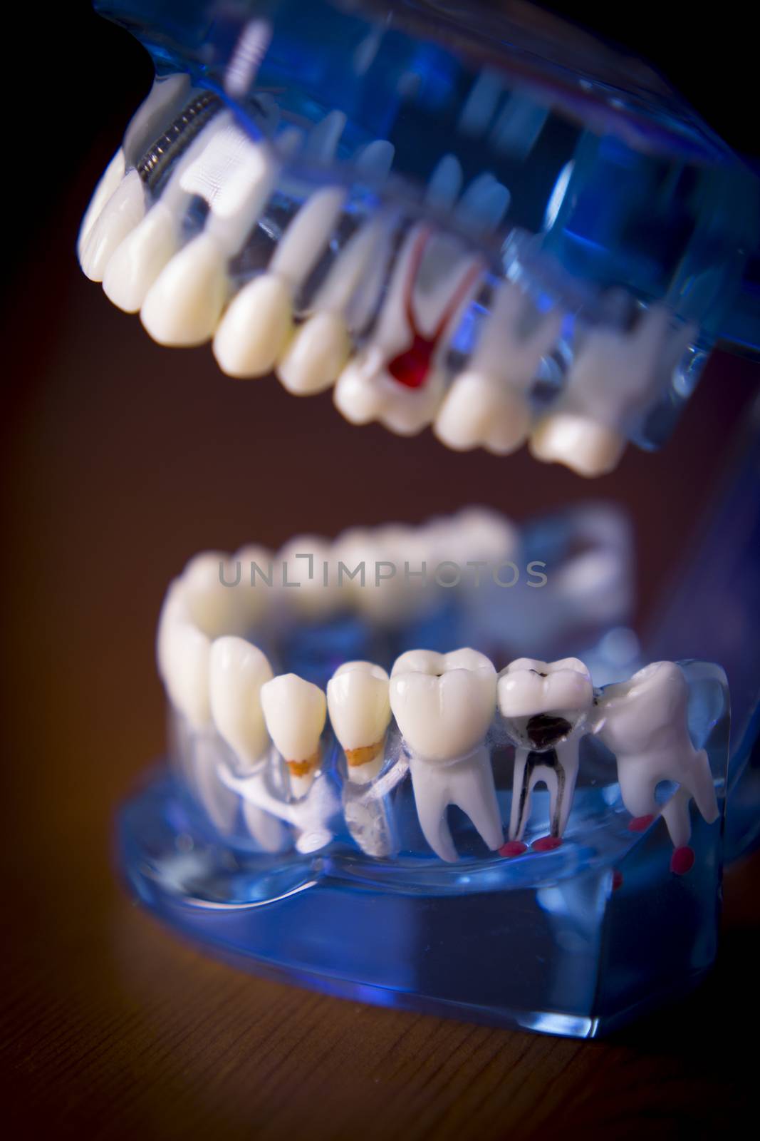 Denture for dentistry students with different health problems