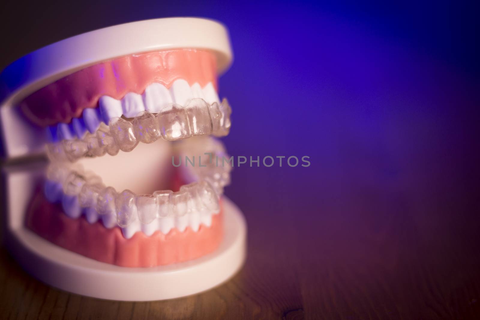 Denture for dentistry students with transparent orthodontics