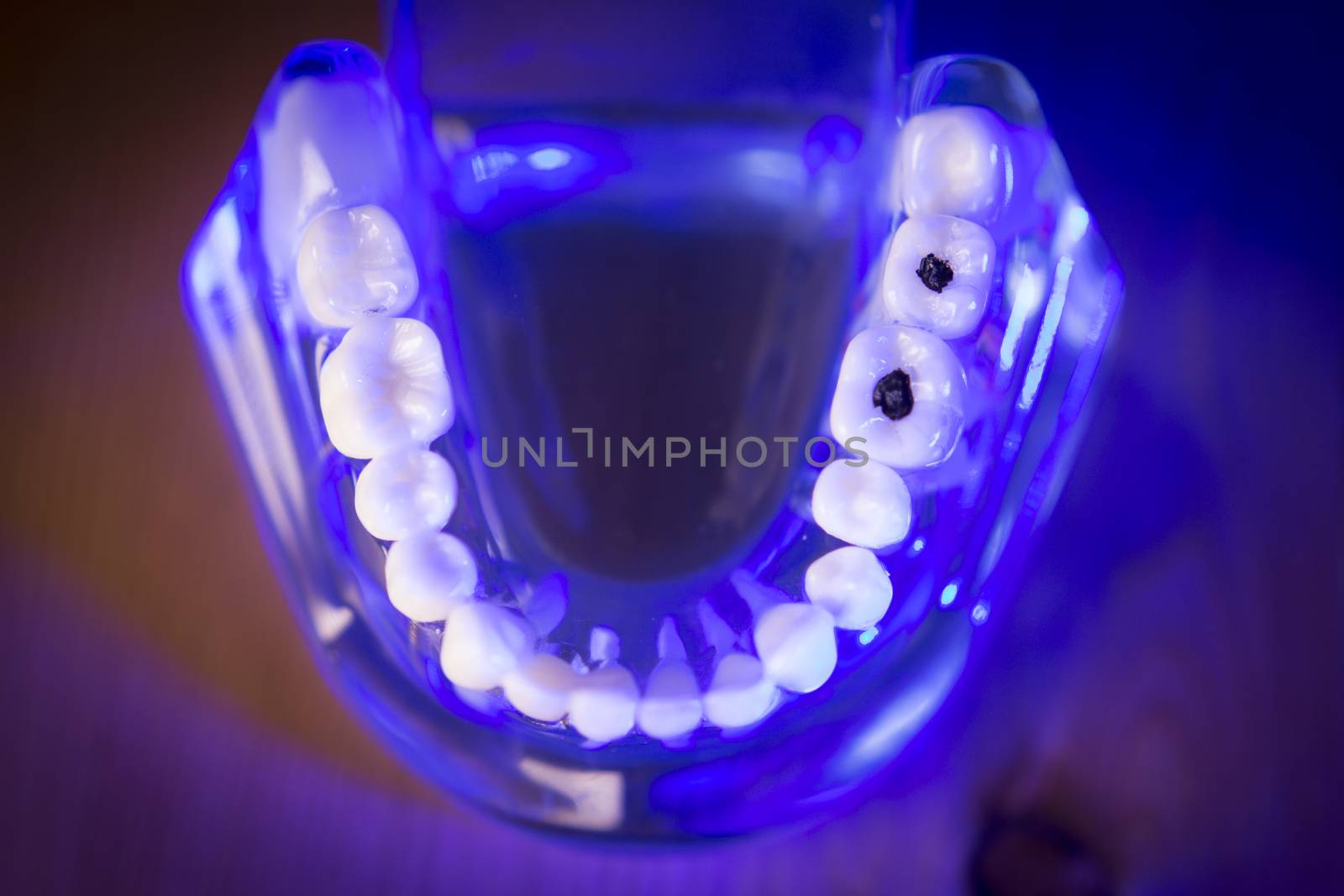 Denture for dentistry students with different health problems