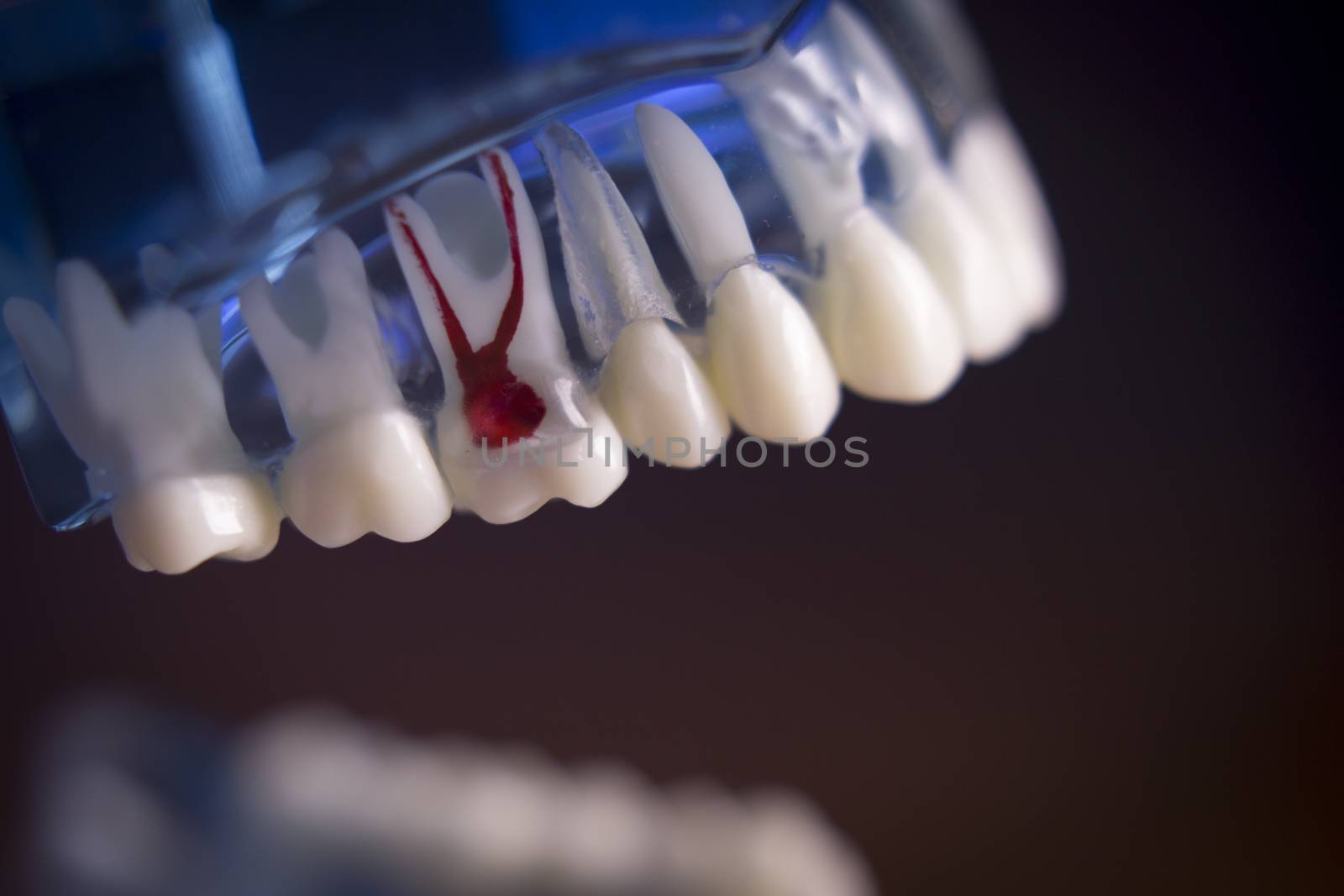 Denture for dentistry students by GemaIbarra