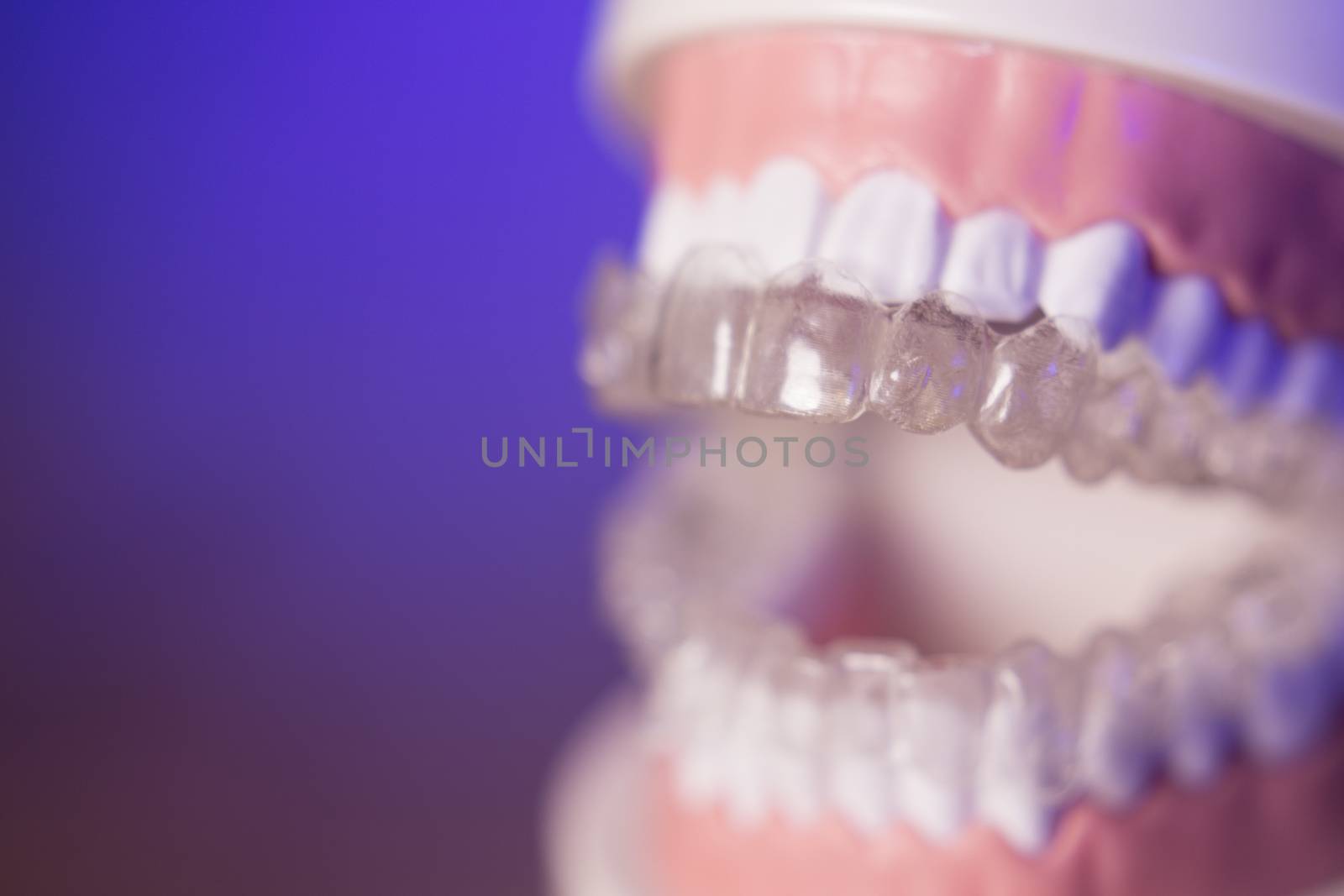 Denture for dentistry students with transparent orthodontics