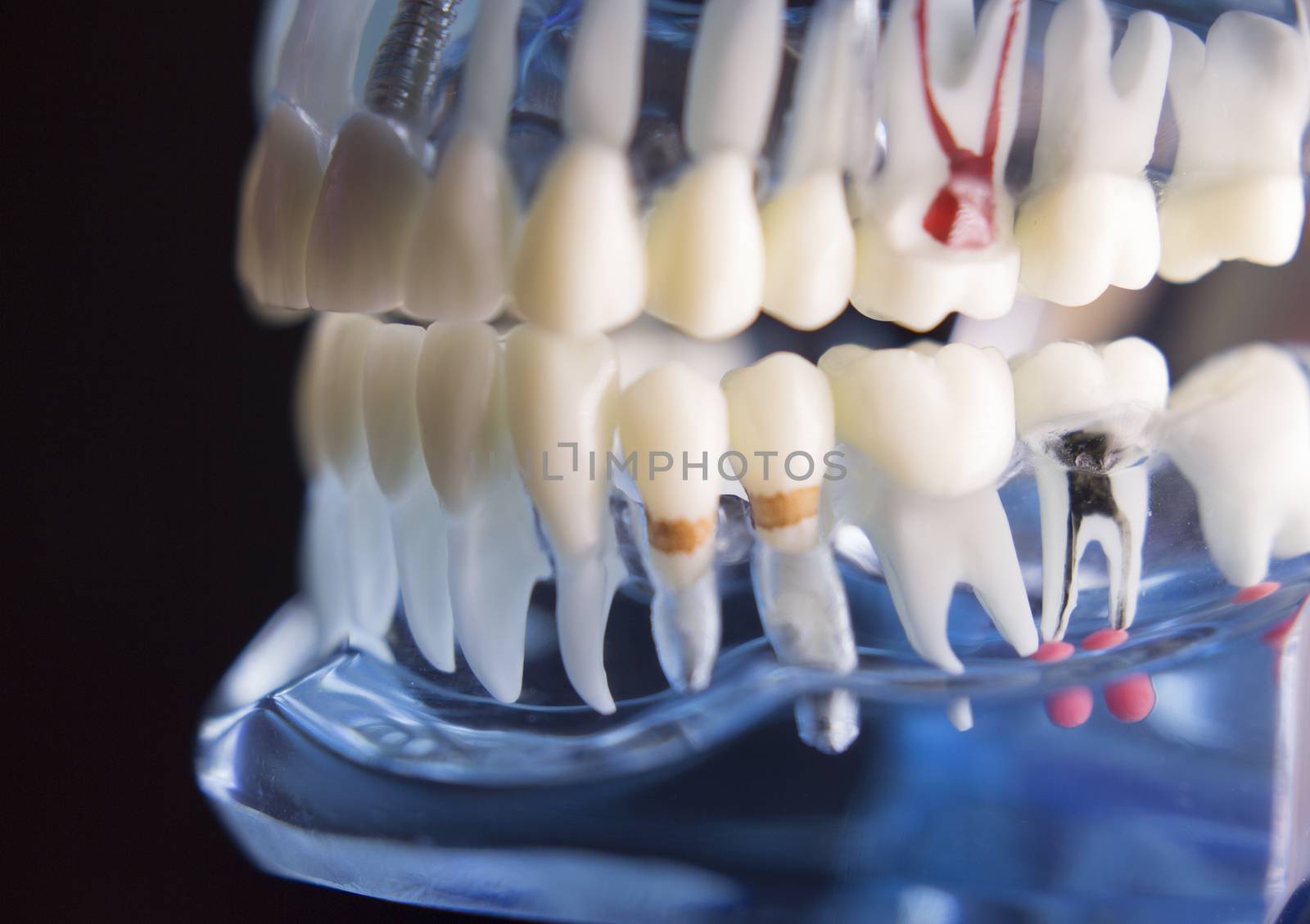 Denture for dentistry students with different health problems