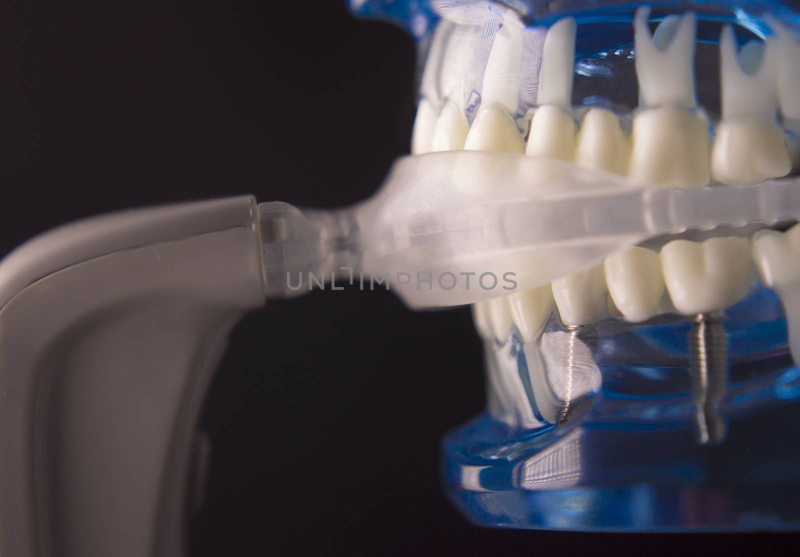 Vibrating dental device with invisible orthodontics by GemaIbarra