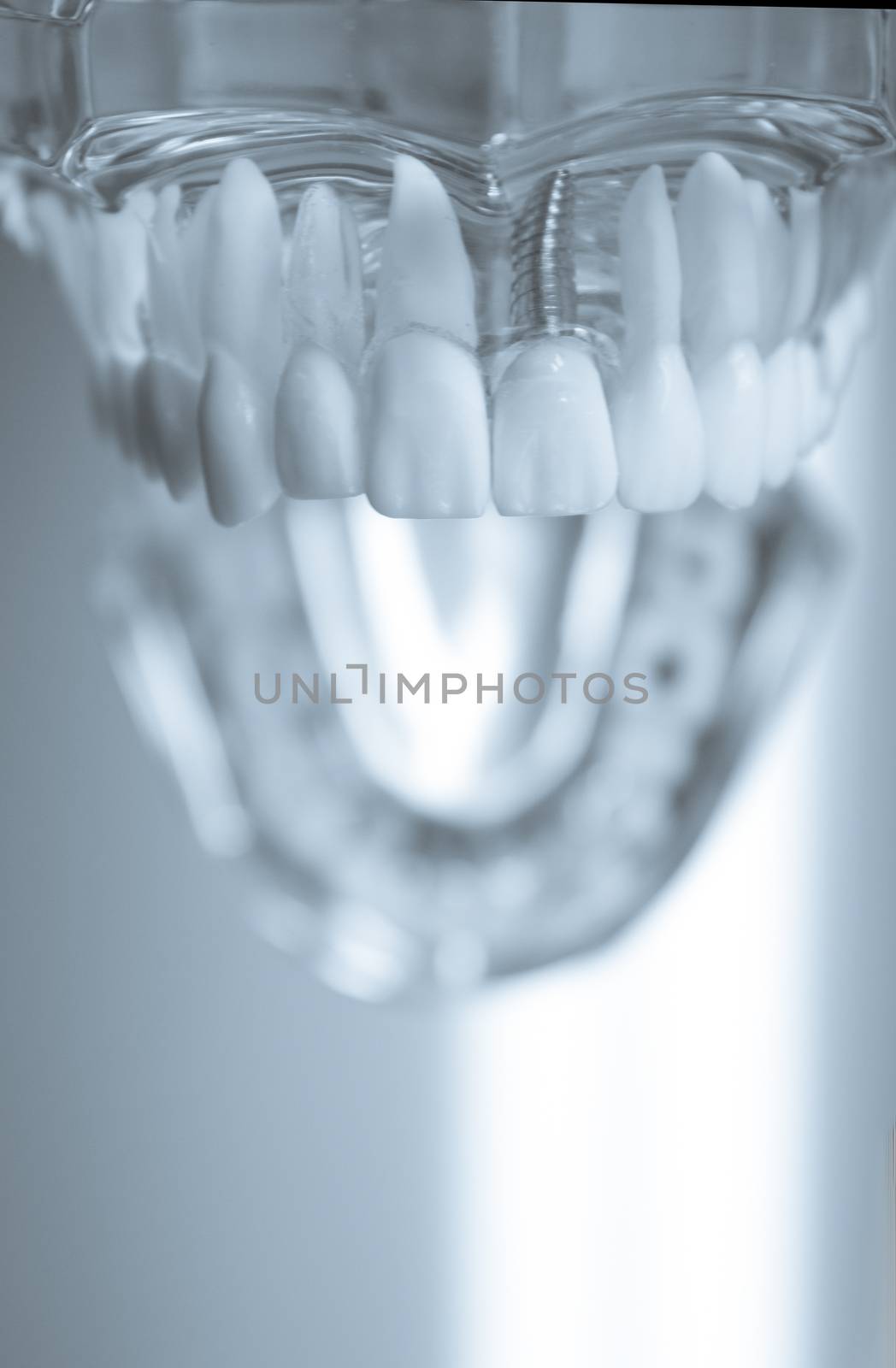 False teeth sample for dentists