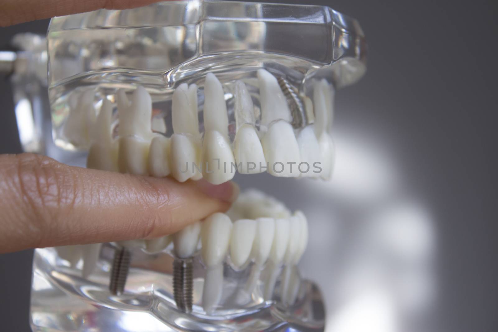 False teeth gripped by the hand of a woman
