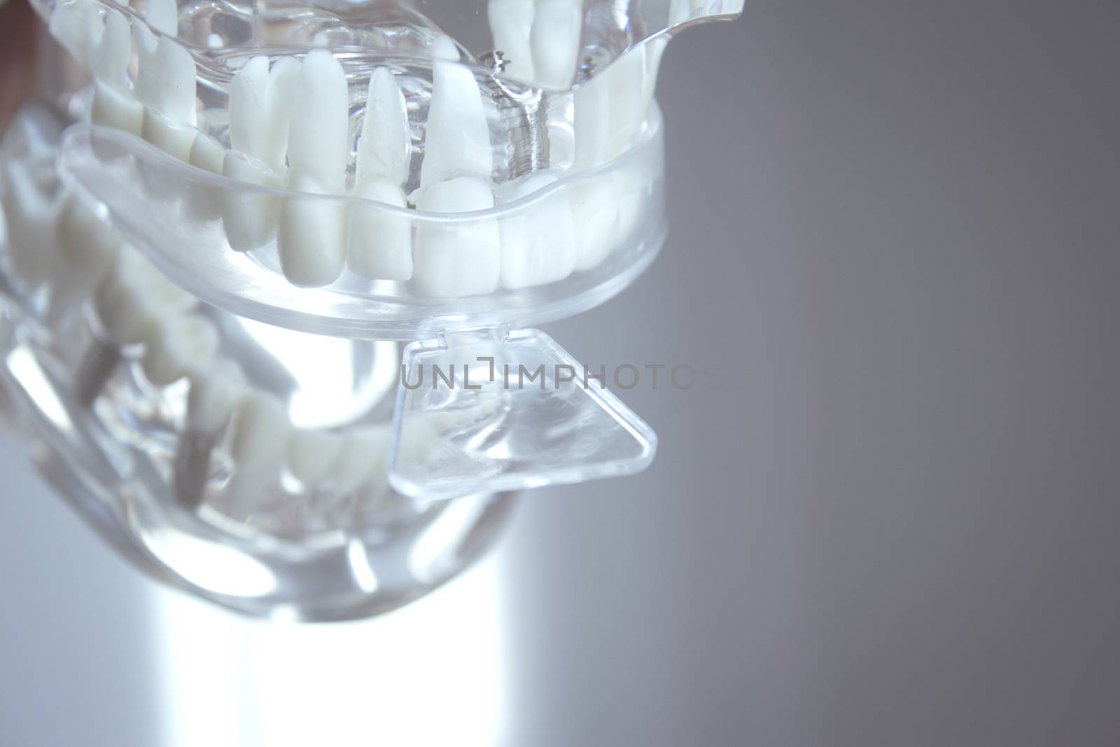 Silicone molds placed on false teeth by GemaIbarra