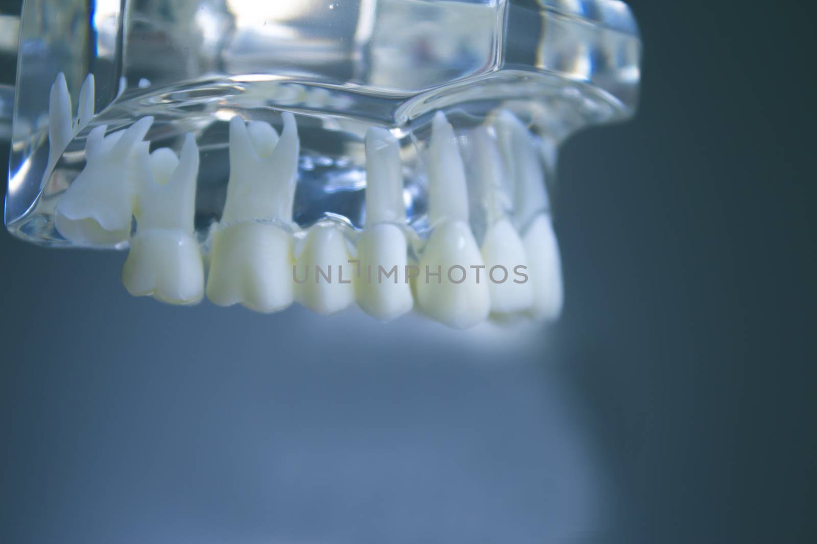 Denture for students transparent by GemaIbarra