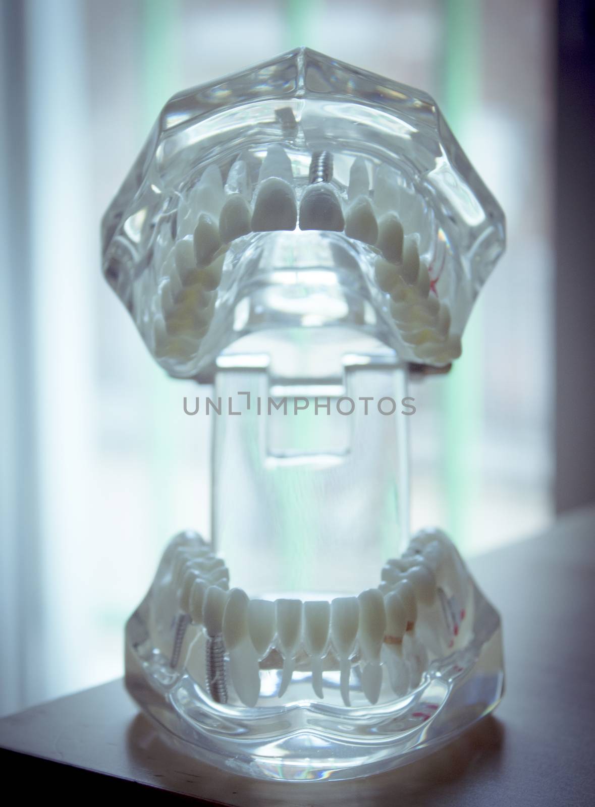 Denture for students transparent by GemaIbarra