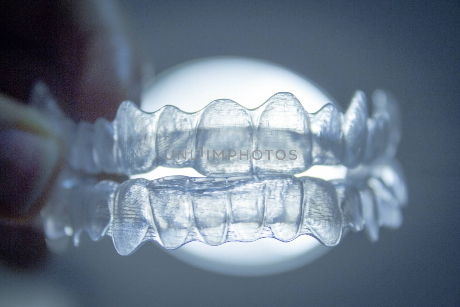 Transparent dental orthodontics with white light background