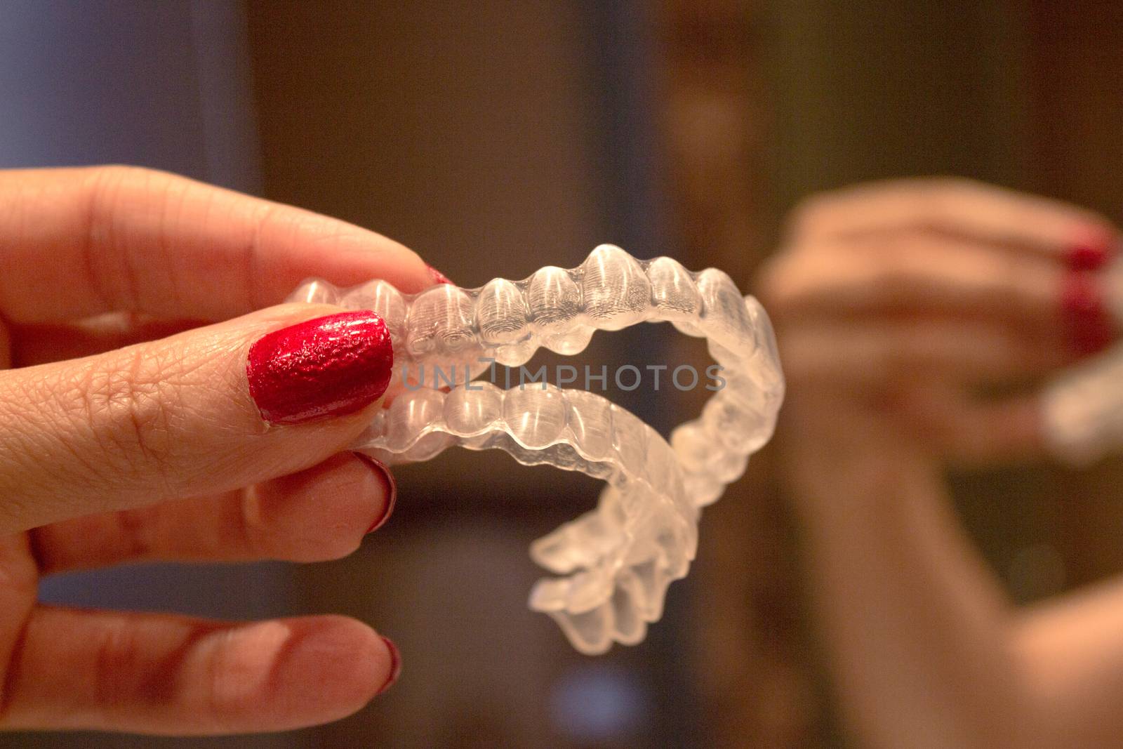 Invisible orthodontics for aligning teeth