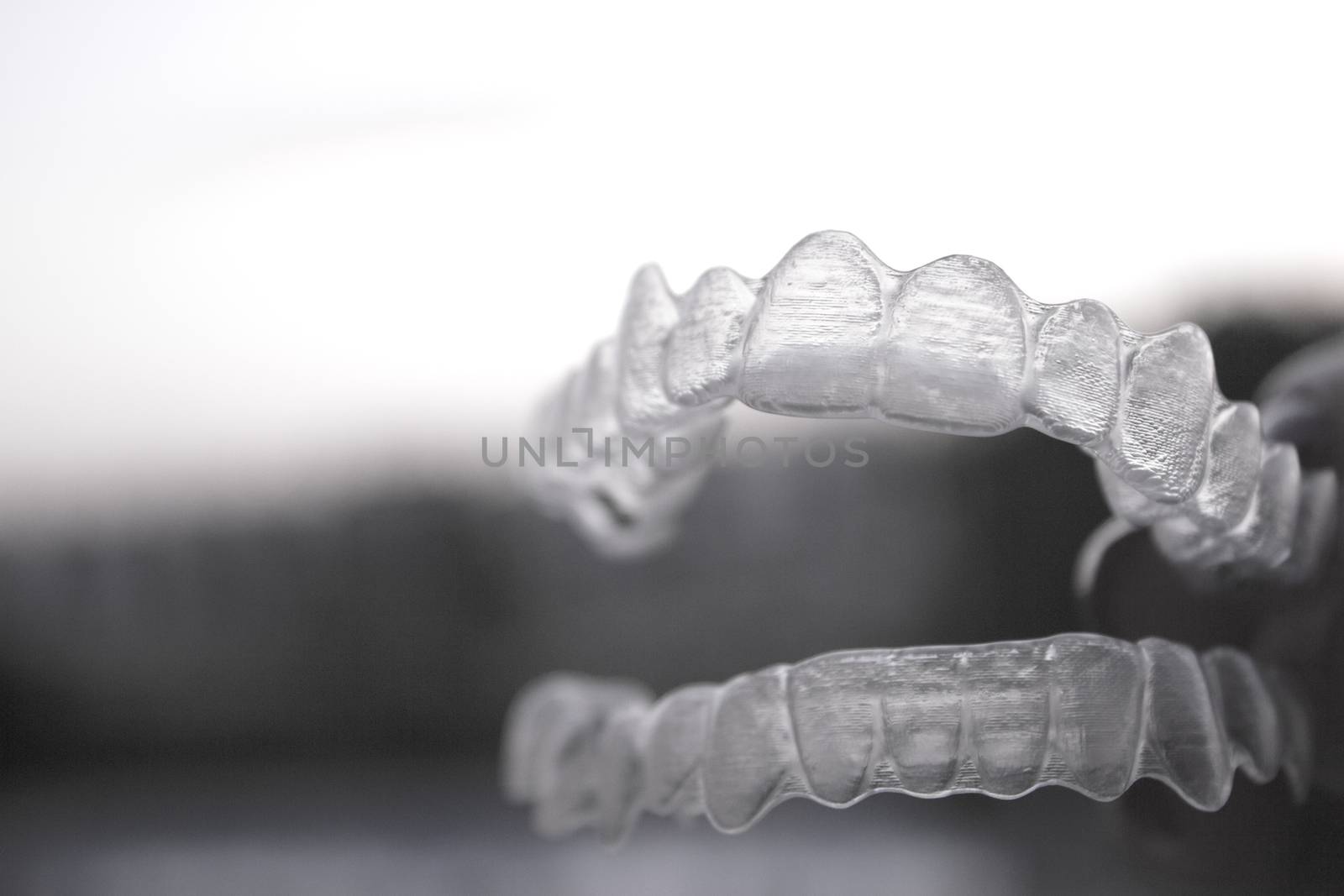 Orthodontics to correct alignment of teeth by GemaIbarra