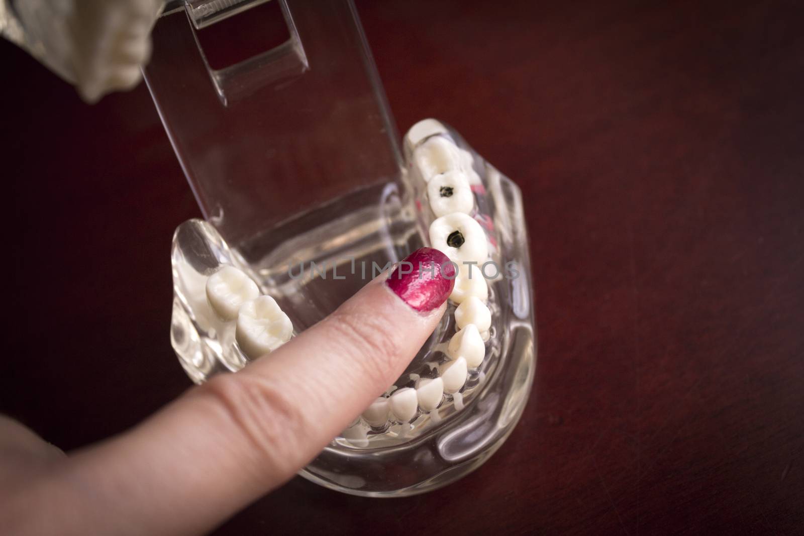 Denture pointed by fingers of woman