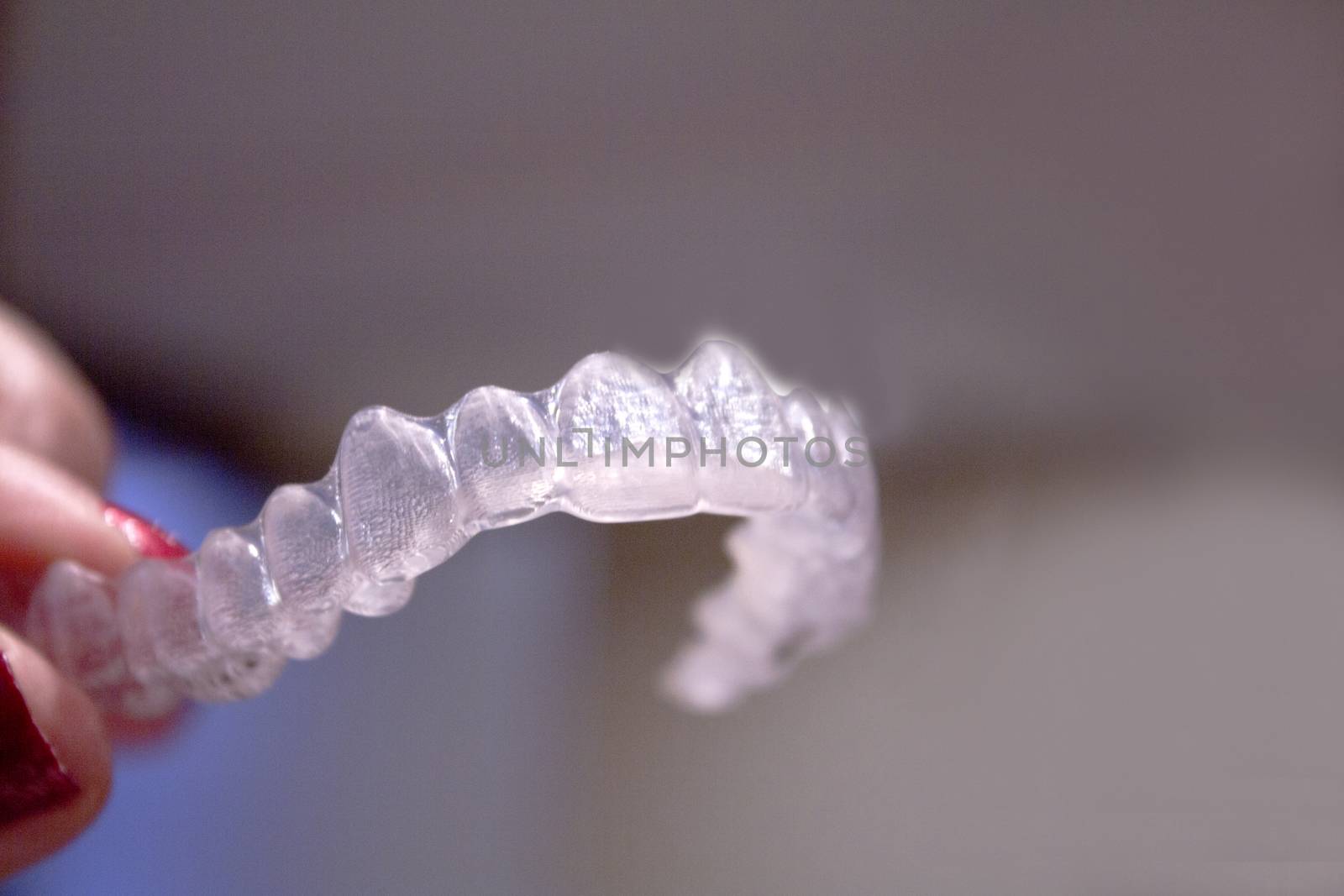 Invisible orthodontics for aligning teeth