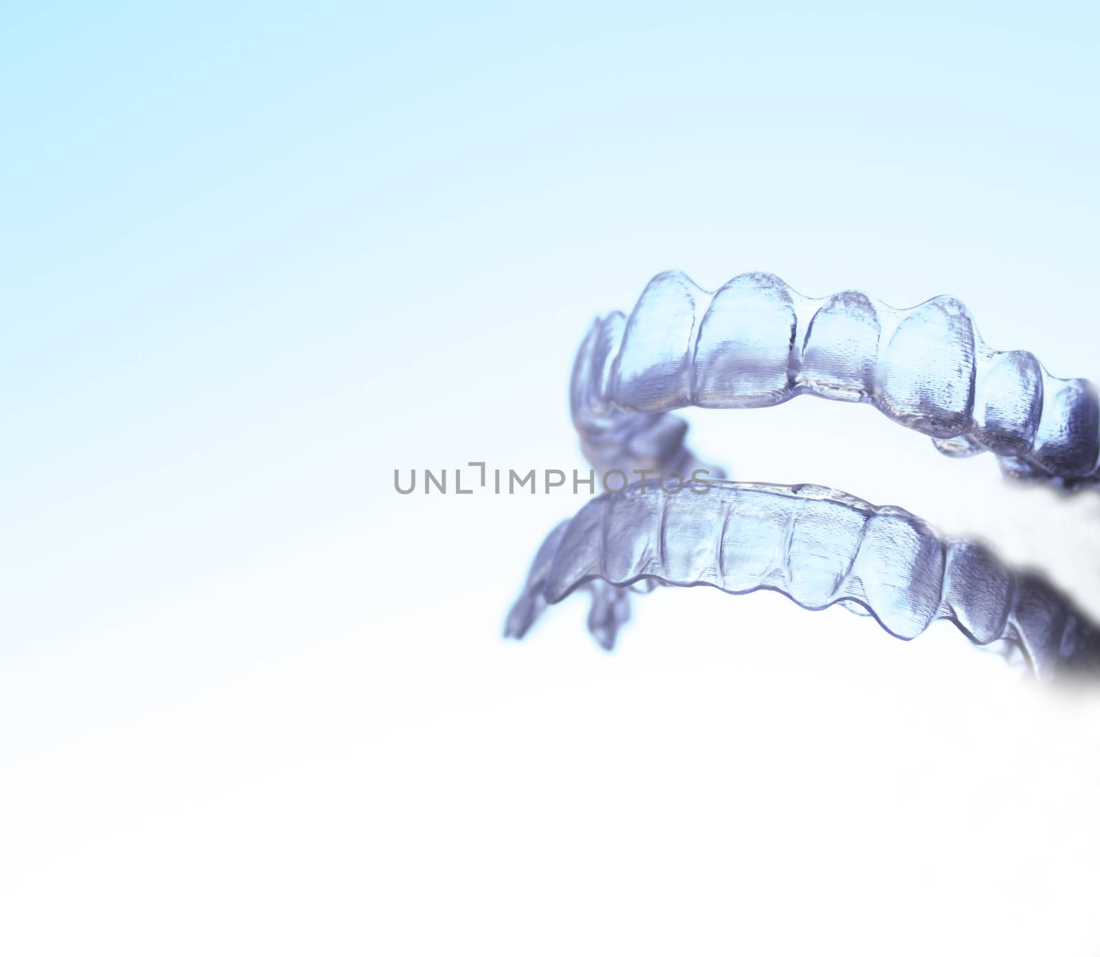 Dental retainer for correction and alignment