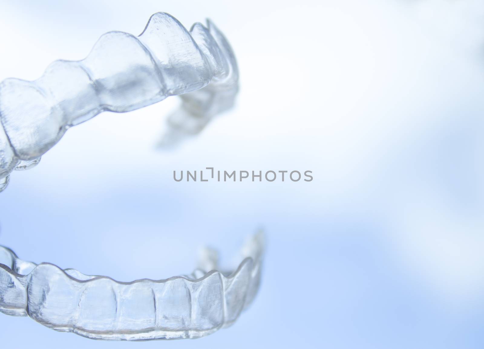 Invisible orthodontics to align the teeth