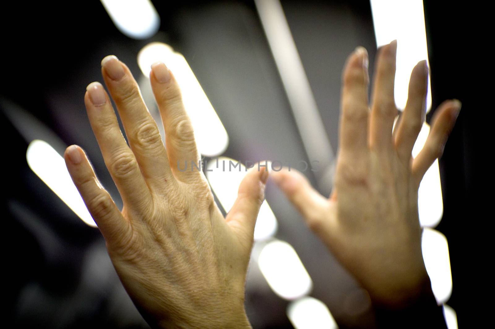 Hands of a middle aged woman with problems of rheumatism, osteoarthritis and skin blemishes