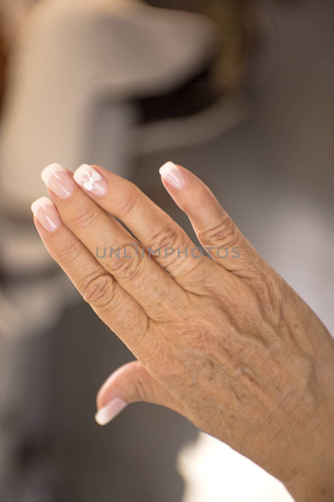 Hands of a middle aged woman with problems of rheumatism, osteoarthritis and skin blemishes