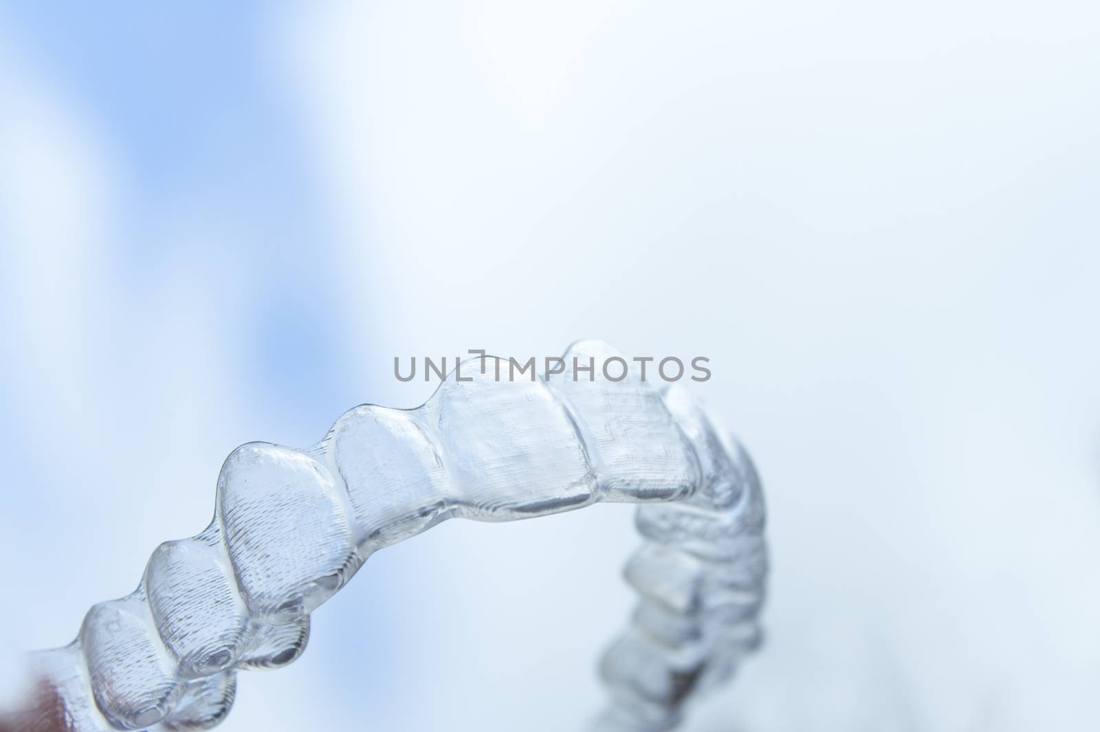 Invisible orthodontics to align the teeth