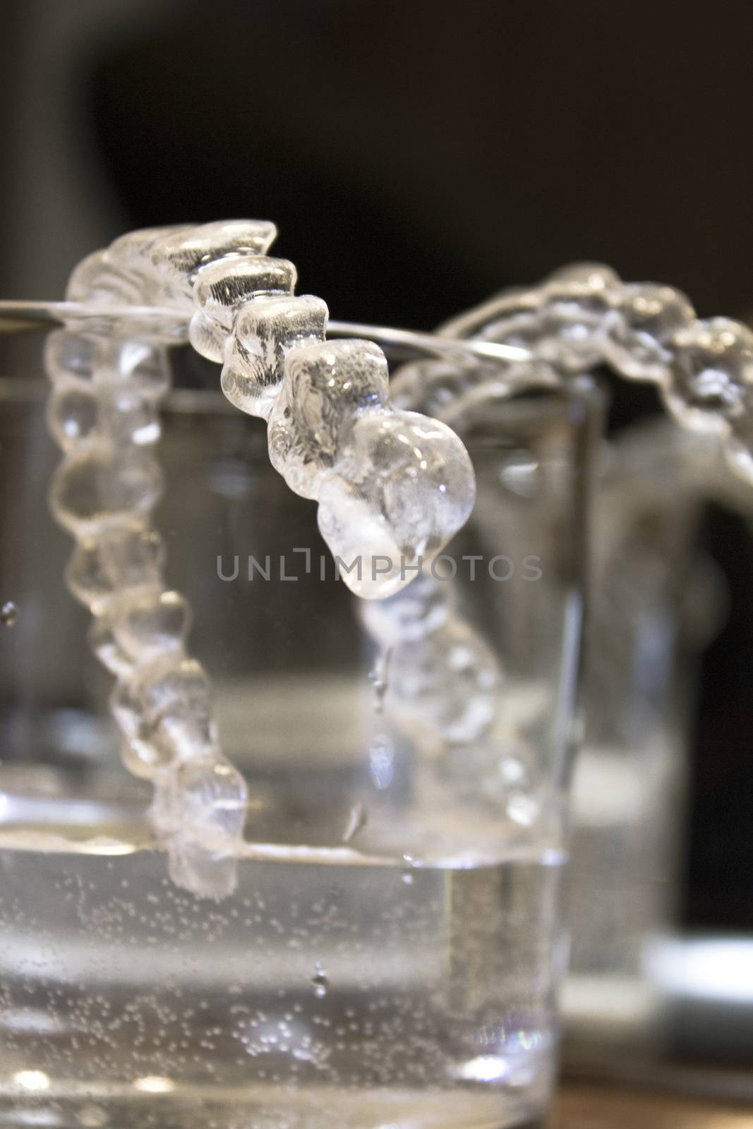 Transparent dental correction orthodontics by GemaIbarra