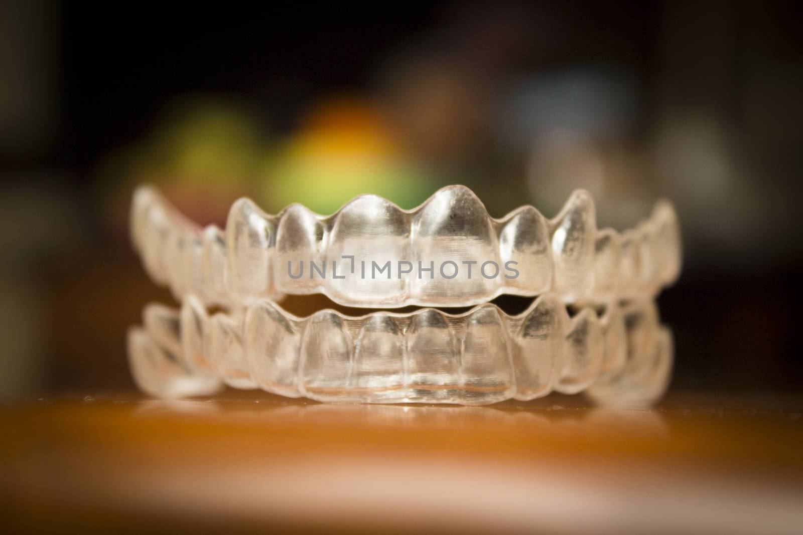 Invisible orthodontics to align the teeth