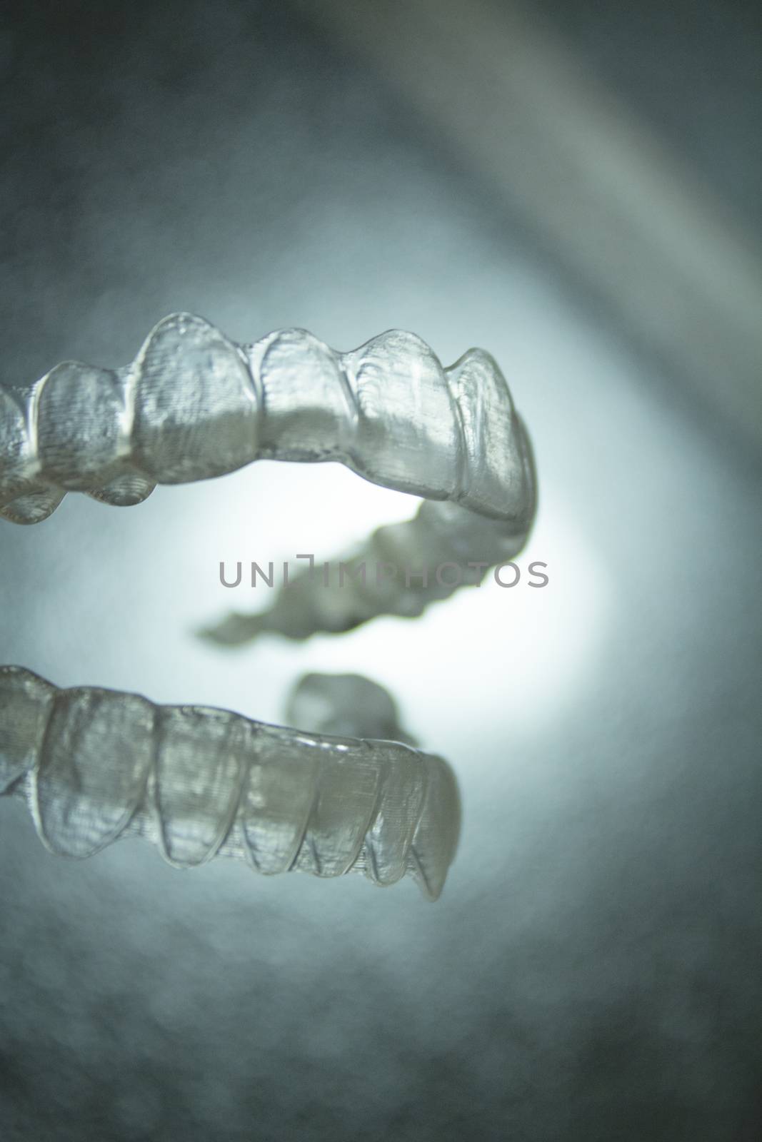 Transparent dental orthodontics to correct dental alignment by GemaIbarra