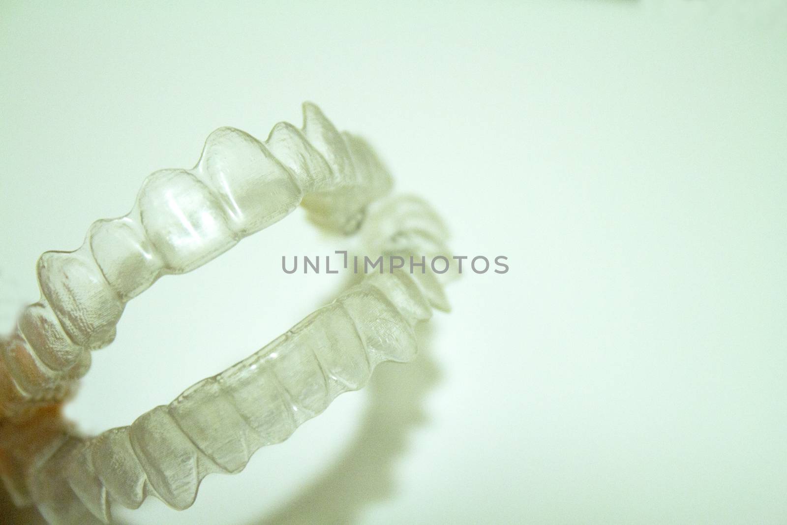 Transparent dental orthodontics to correct dental alignment. No people