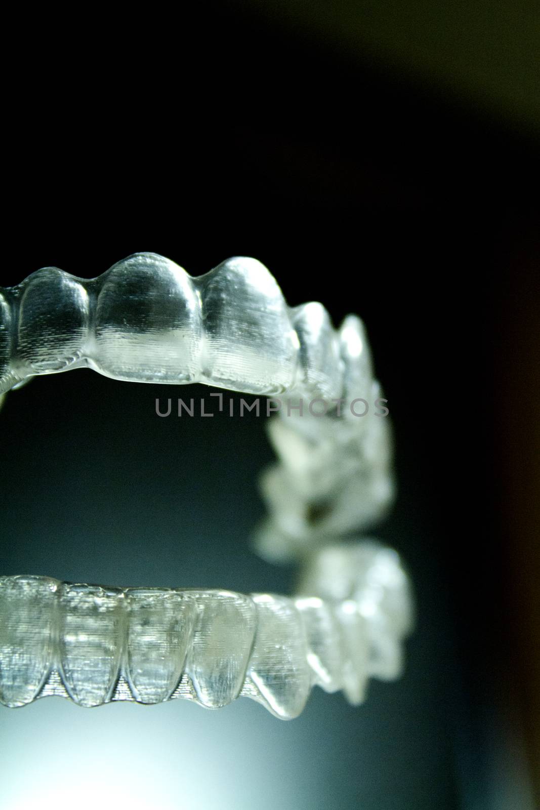 Transparent dental orthodontics to correct dental alignment by GemaIbarra