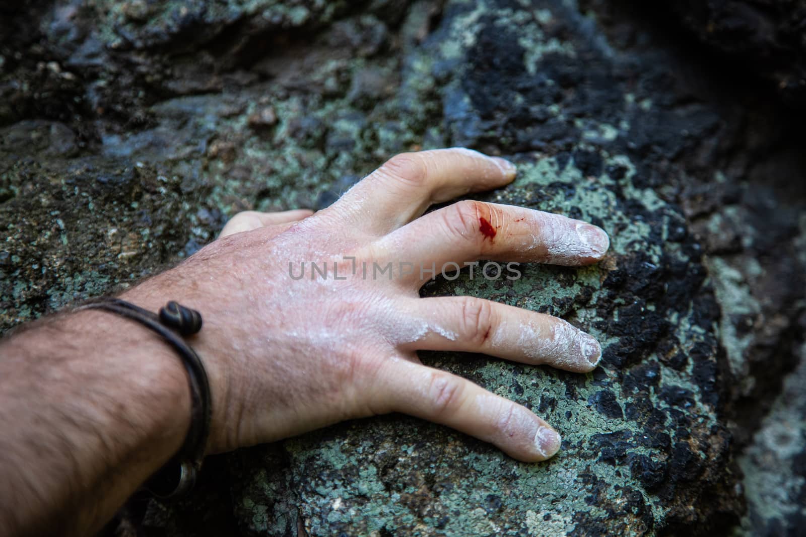 hand of rock climber with injured bleeding fingers covered with magnesia