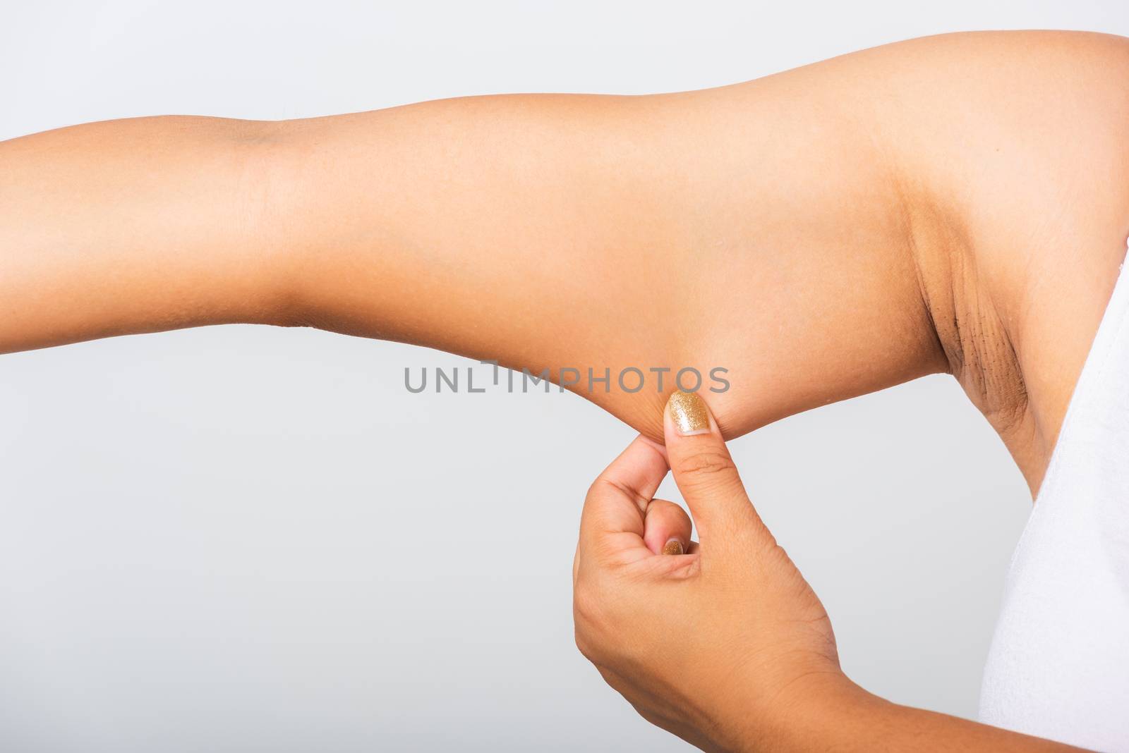 woman pulling excess fat on her under arm, problem armpit skin by Sorapop