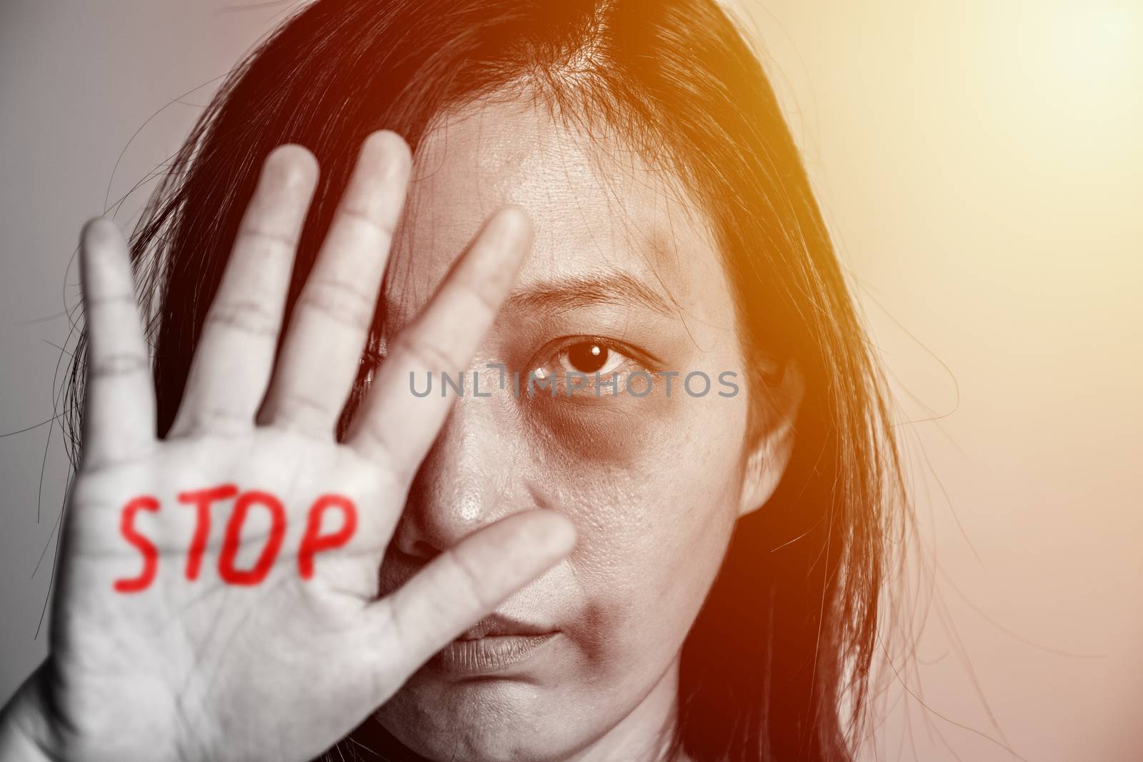 stop violence against women campaign. Asia woman with bruise on arms and face raised her hand for dissuade, hand write the word STOP in red color. by asiandelight