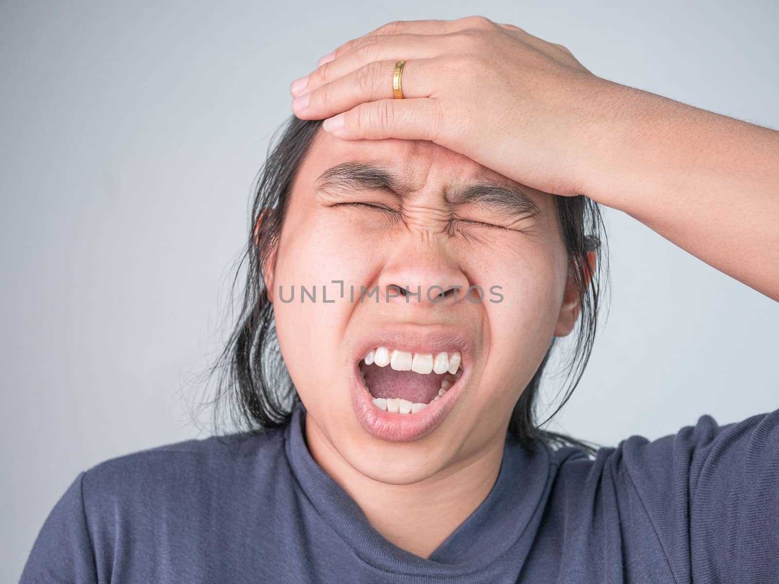 Woman catching on head because she have acute headache. Healthca by TEERASAK