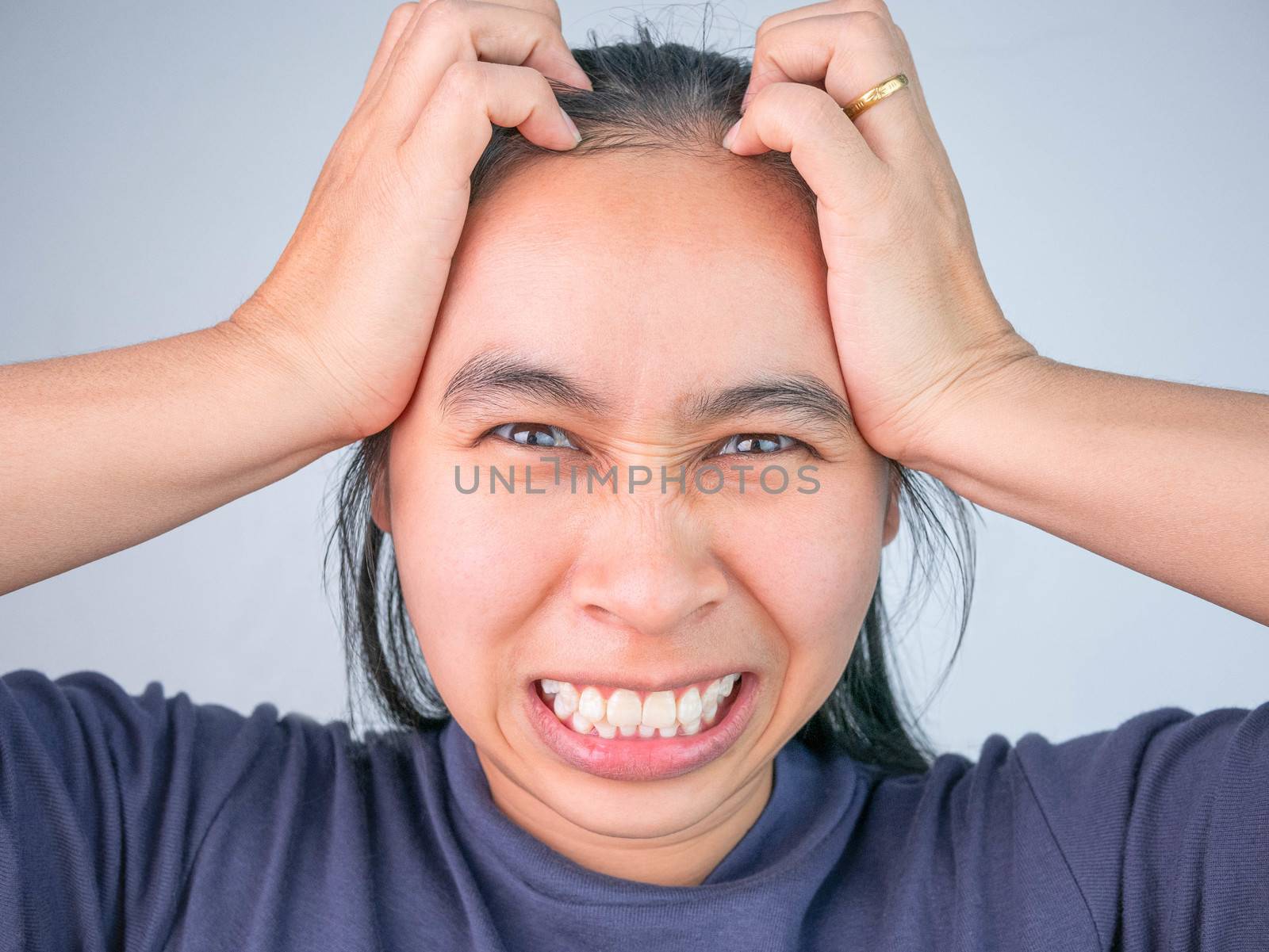 Woman catching on head because she have acute headache. Healthca by TEERASAK