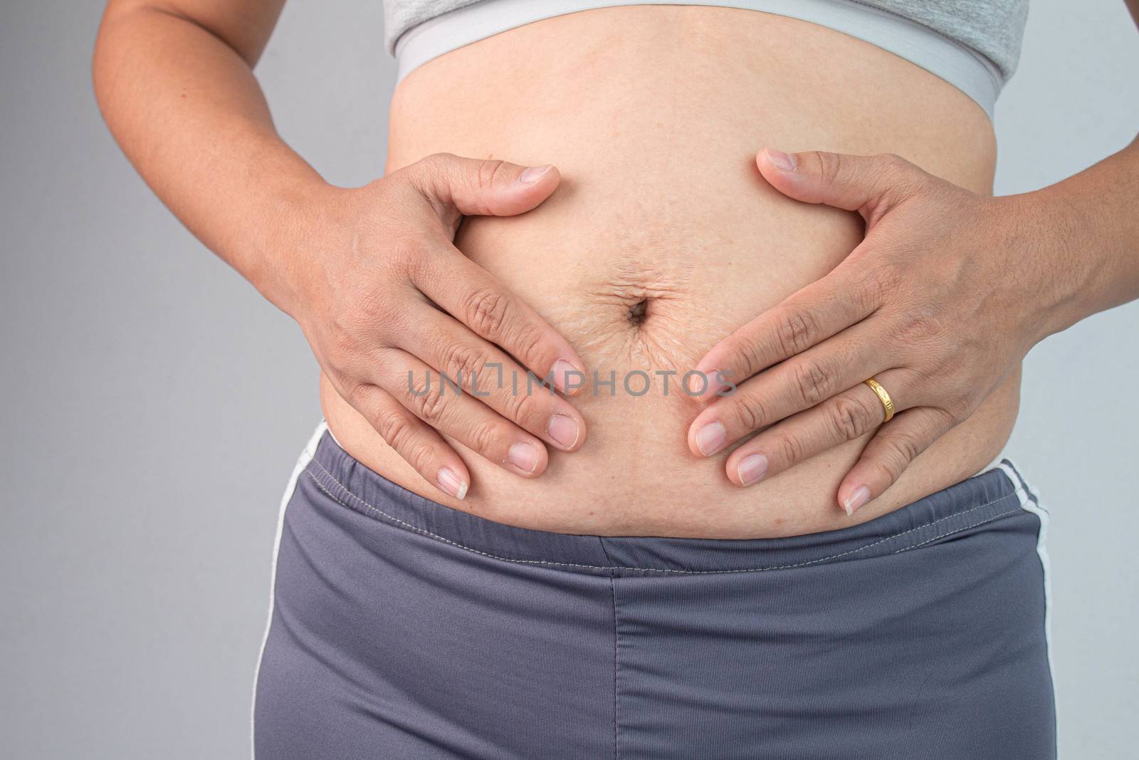 Close up of Woman touching belly skin with stretch marks and loose skin after giving birth. Health care for skin and body shape concept.
