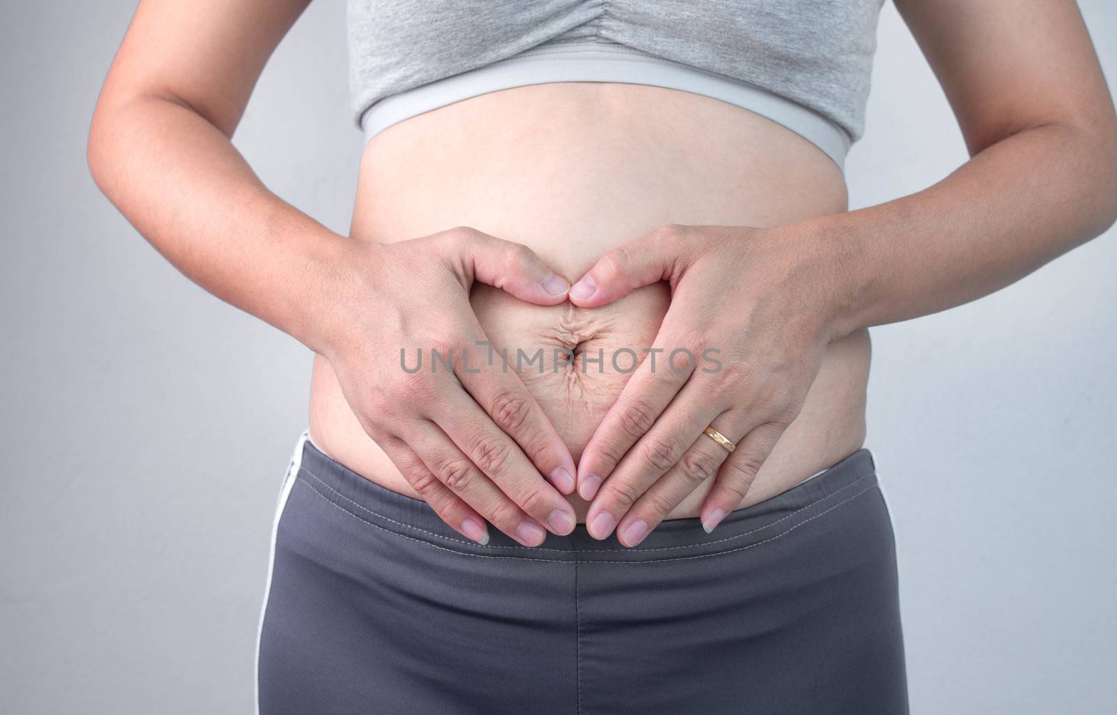 Close up of Woman touching belly skin with stretch marks and loose skin after giving birth. Health care for skin and body shape concept.