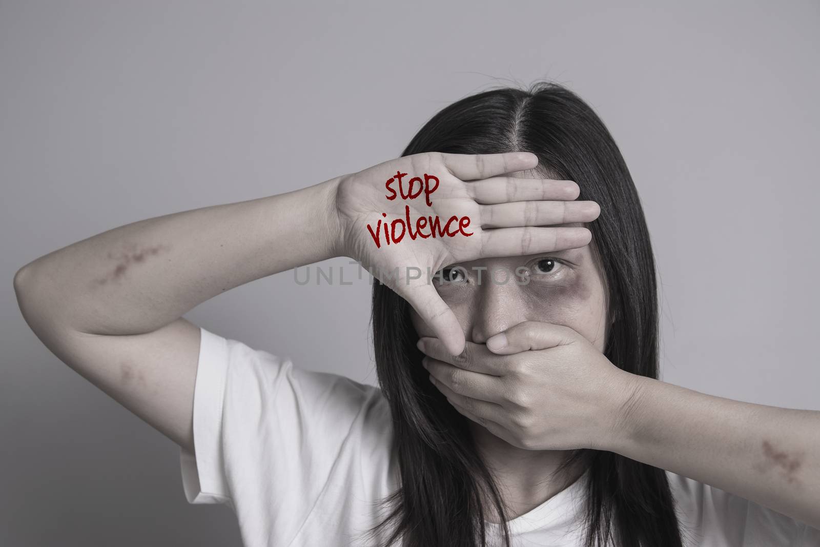 stop violence against women campaign. Asia woman with bruise on arms and face use one hand close mouth and the other hand write the word stop violence. by asiandelight