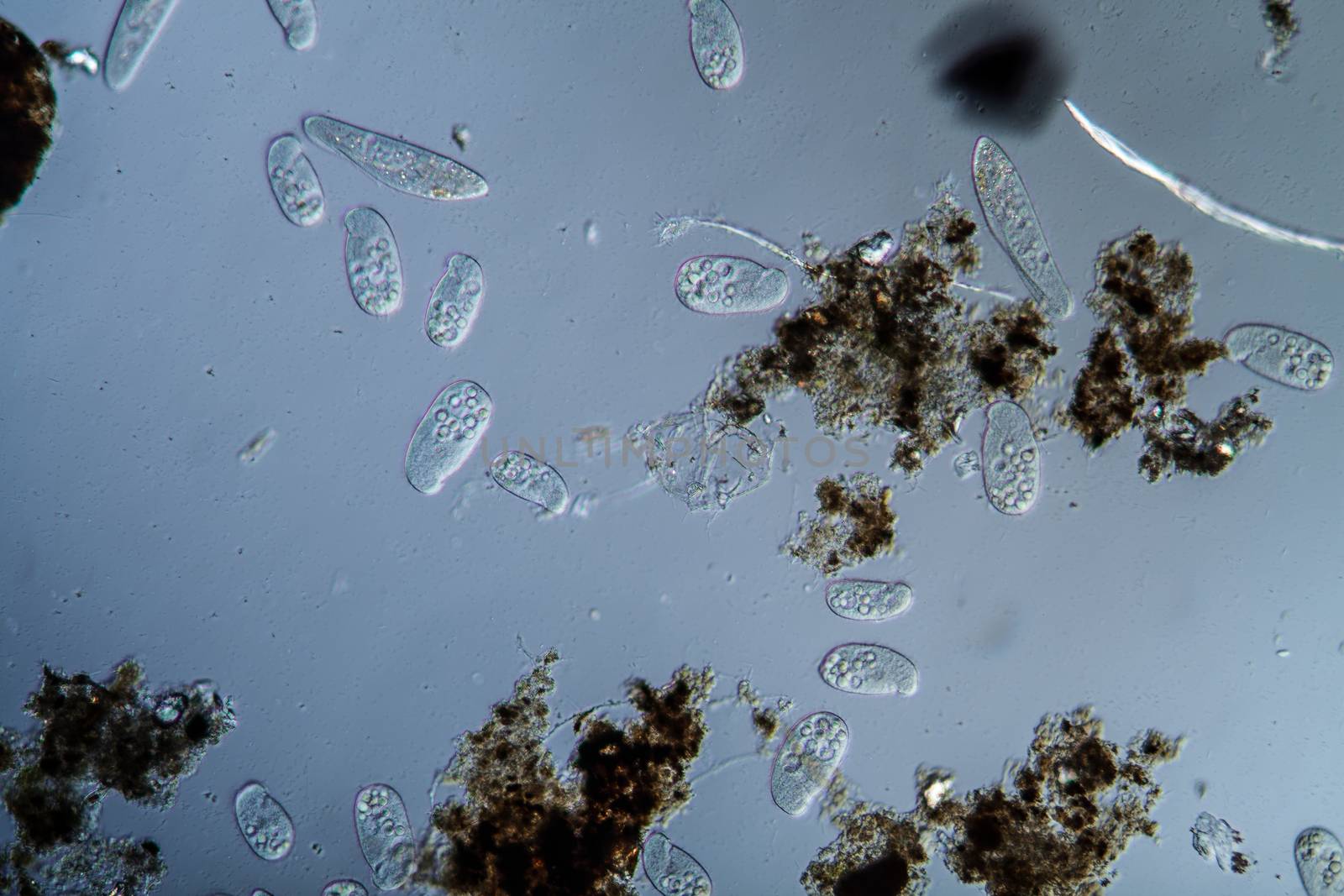 Plankton with microscopic ciliates