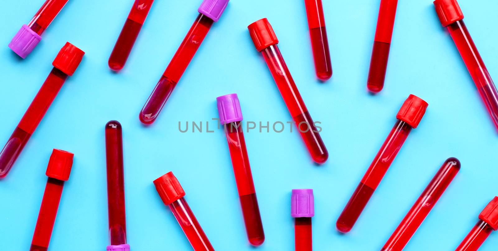 Blood in test tubes on blue background. Top view