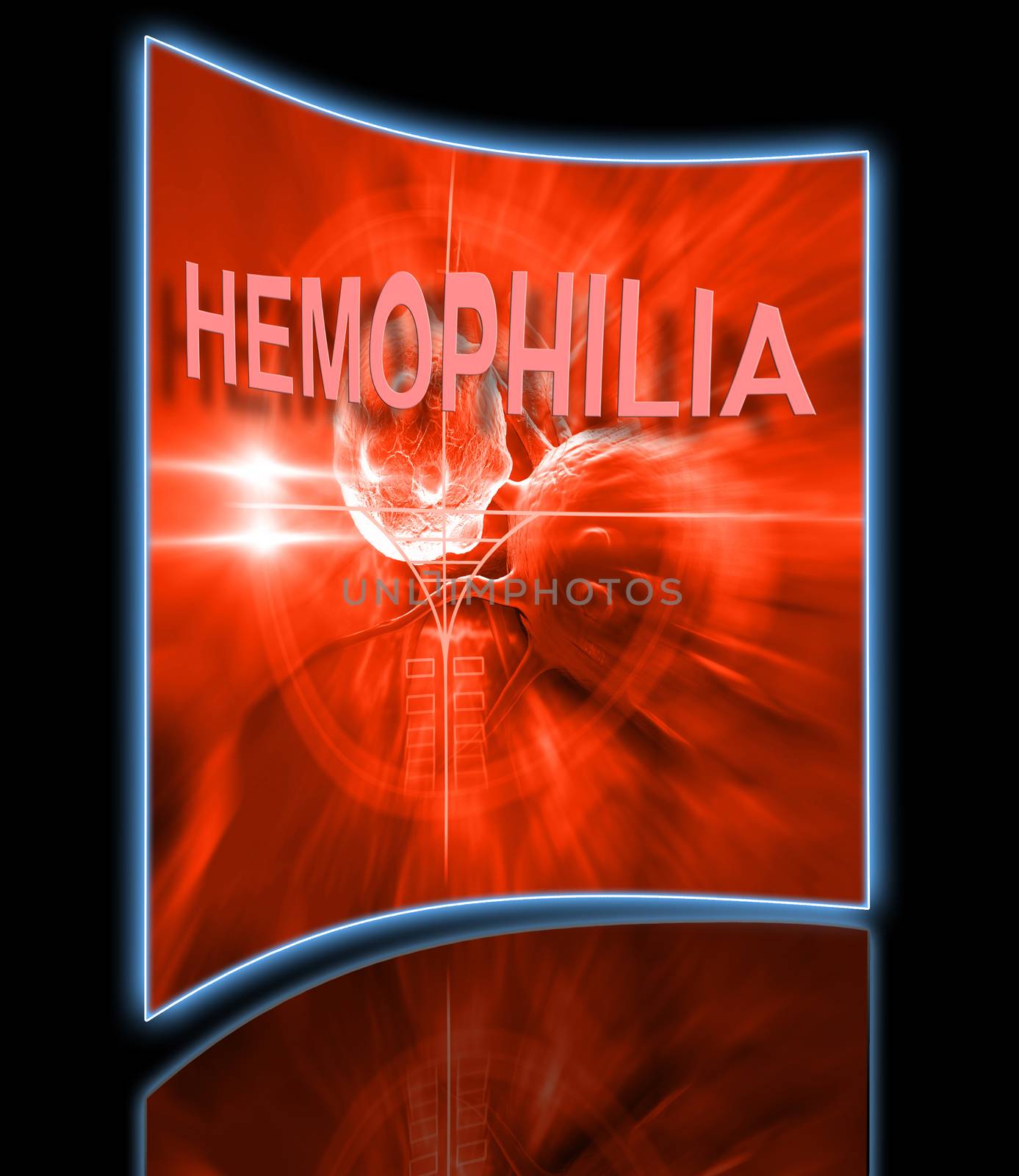 hemophilia by vitanovski
