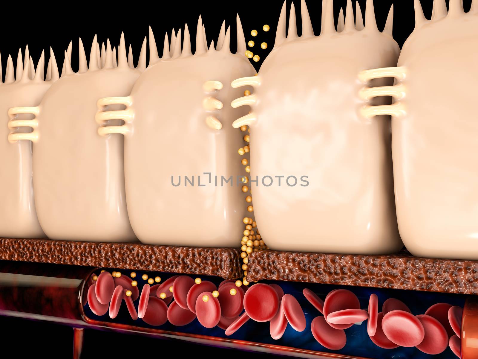 3d Rendering of leaky gut, in intestine with celiac disease and gluten sensitivity these tight junctions come apart