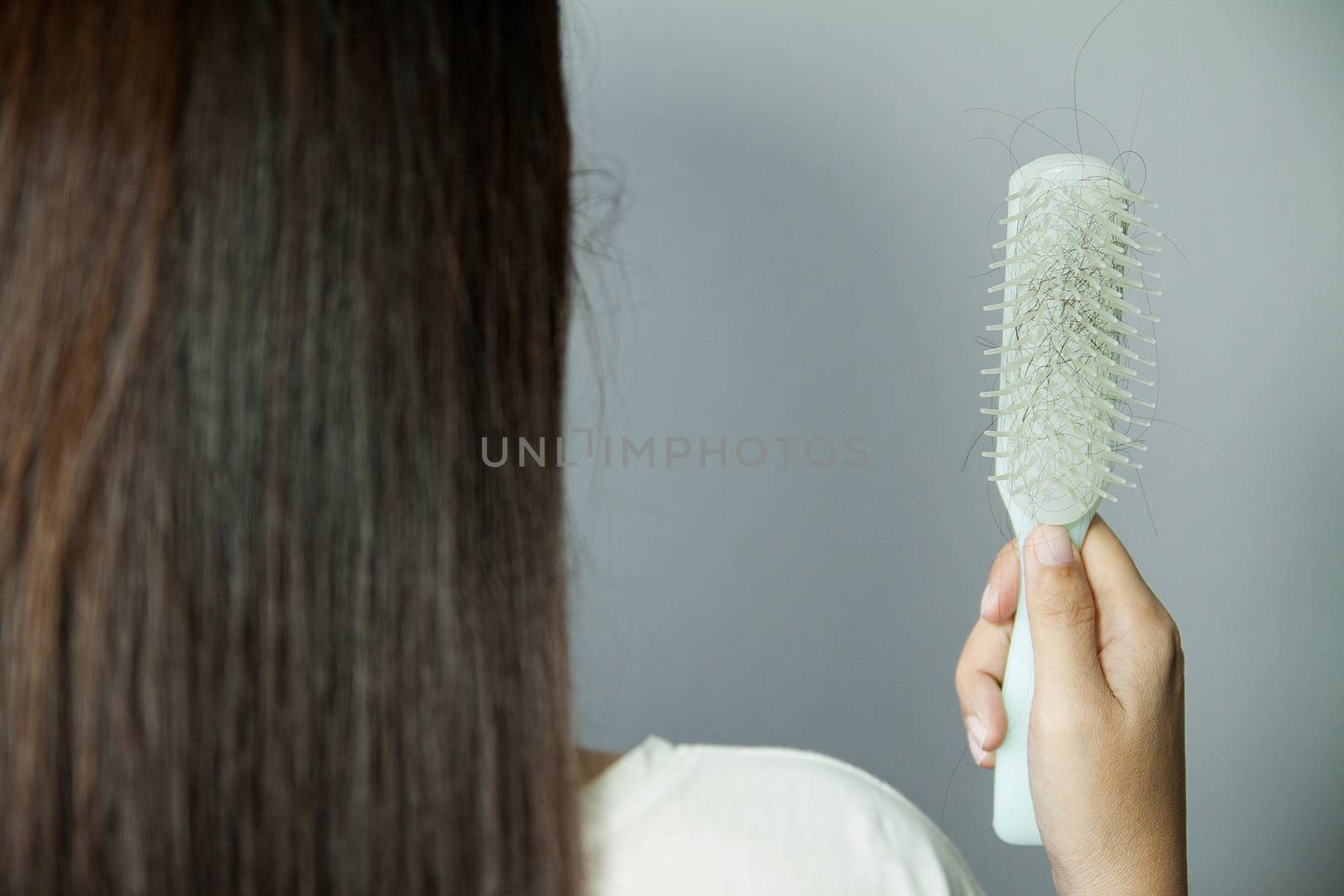 Hair loss problem. Hairs fall in comb, hair fall everyday serious problem