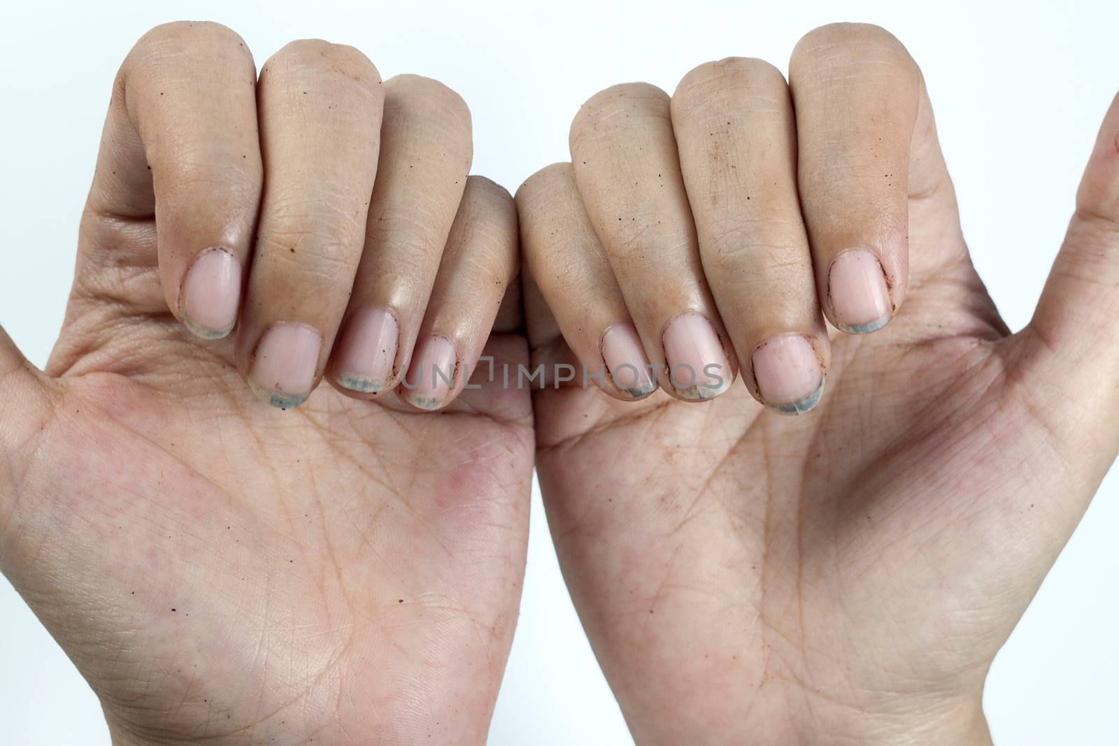 Dirty nails, dirty with dirt lodged in the nails