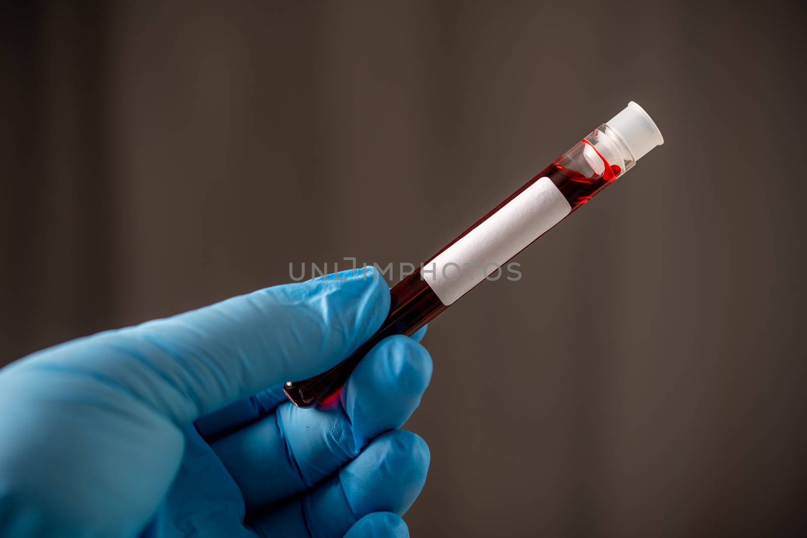 doctor hand wearing blue glove holding blood test tube